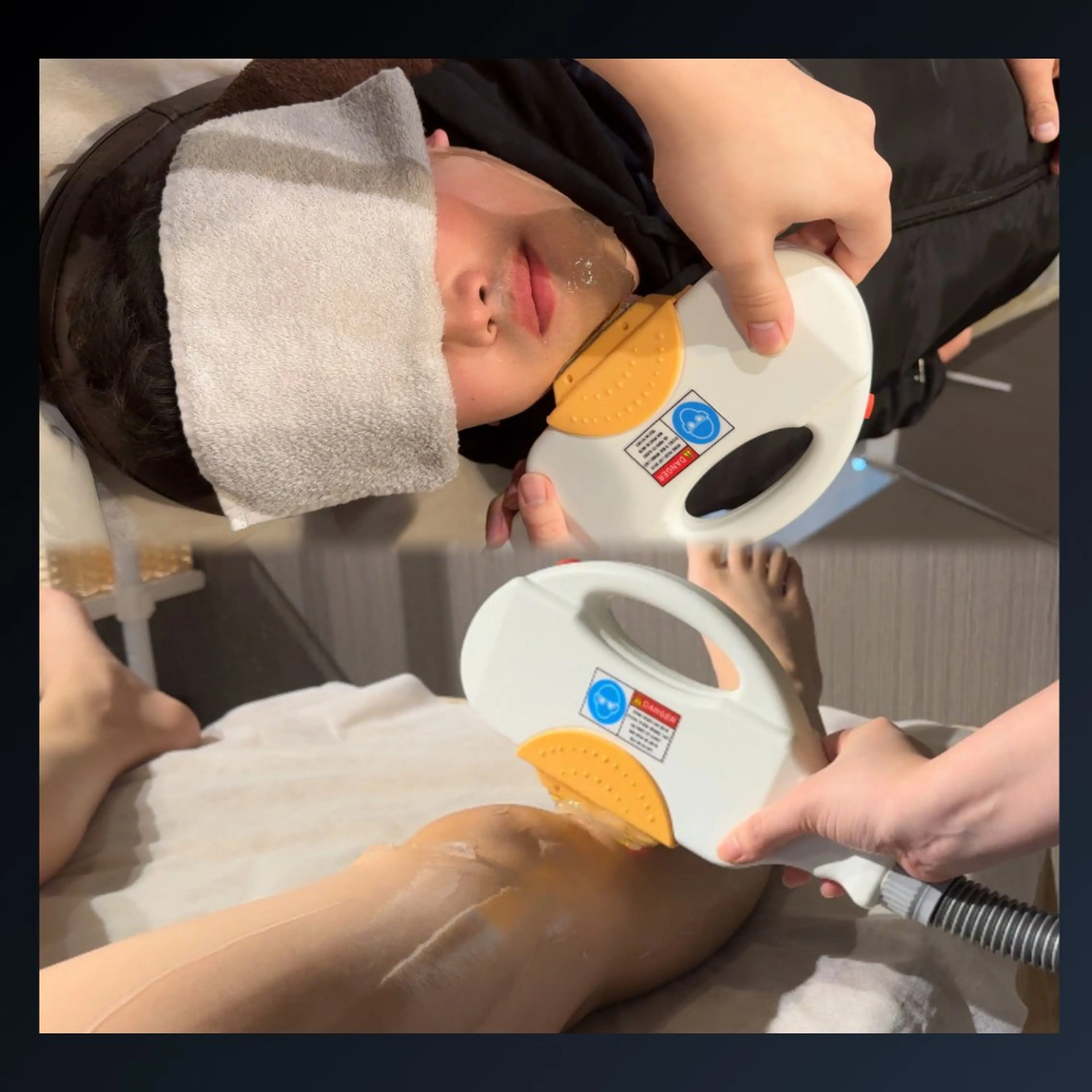大人気メニューの融合!! ヒゲ＆脚脱毛の写真