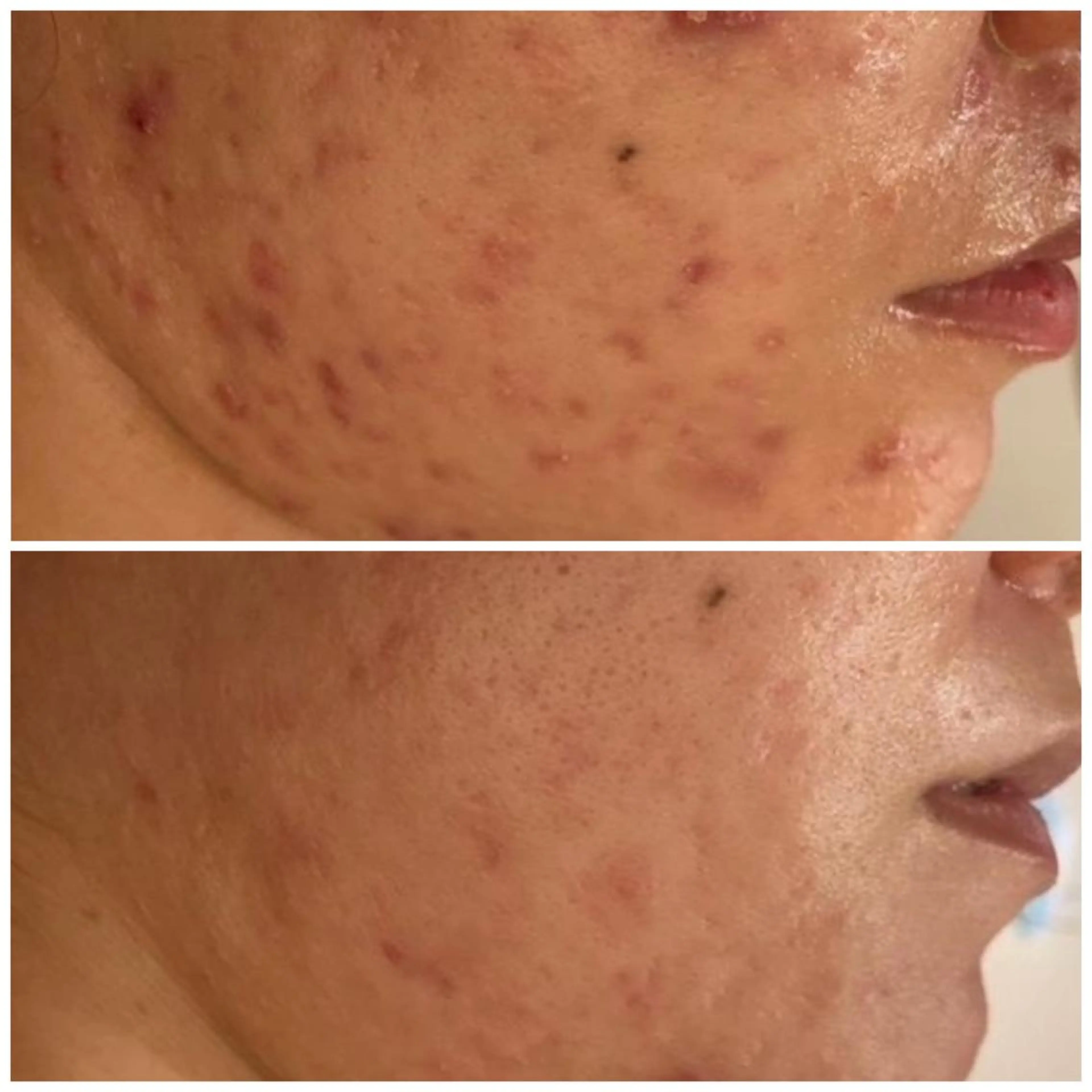 触れたくなる モテ肌へ...❤︎のエステ・リラクイメージ