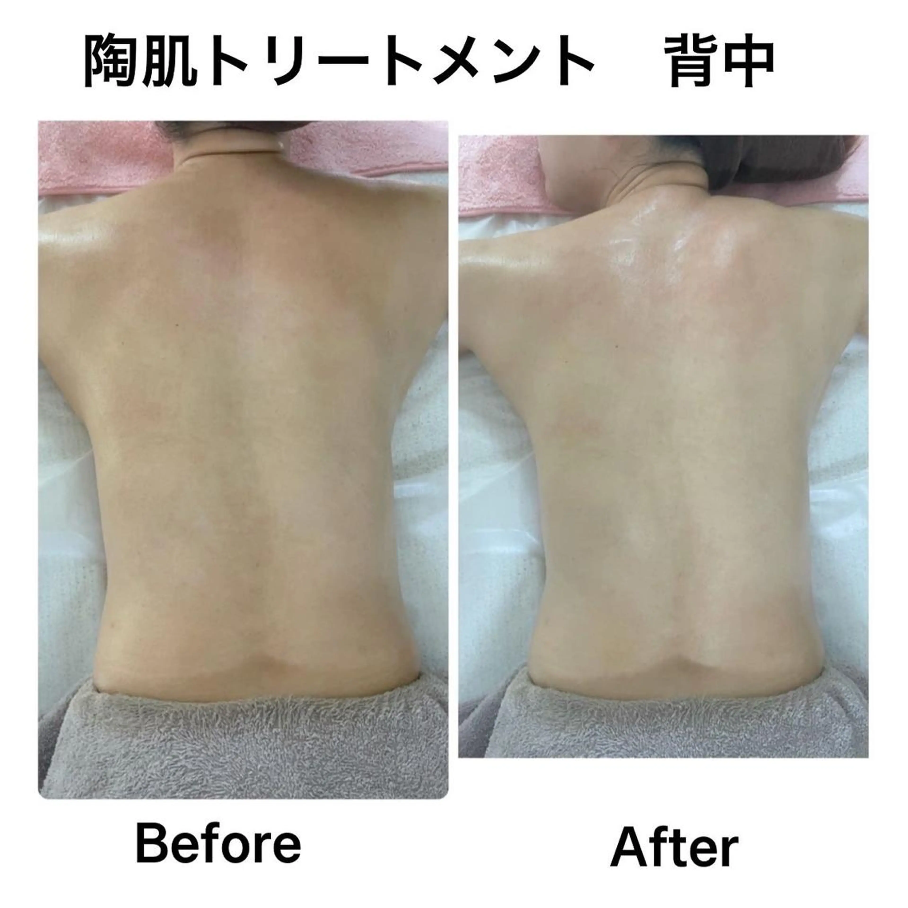 アロマ,陶肌 SalonYokoのエステ・リラクイメージ