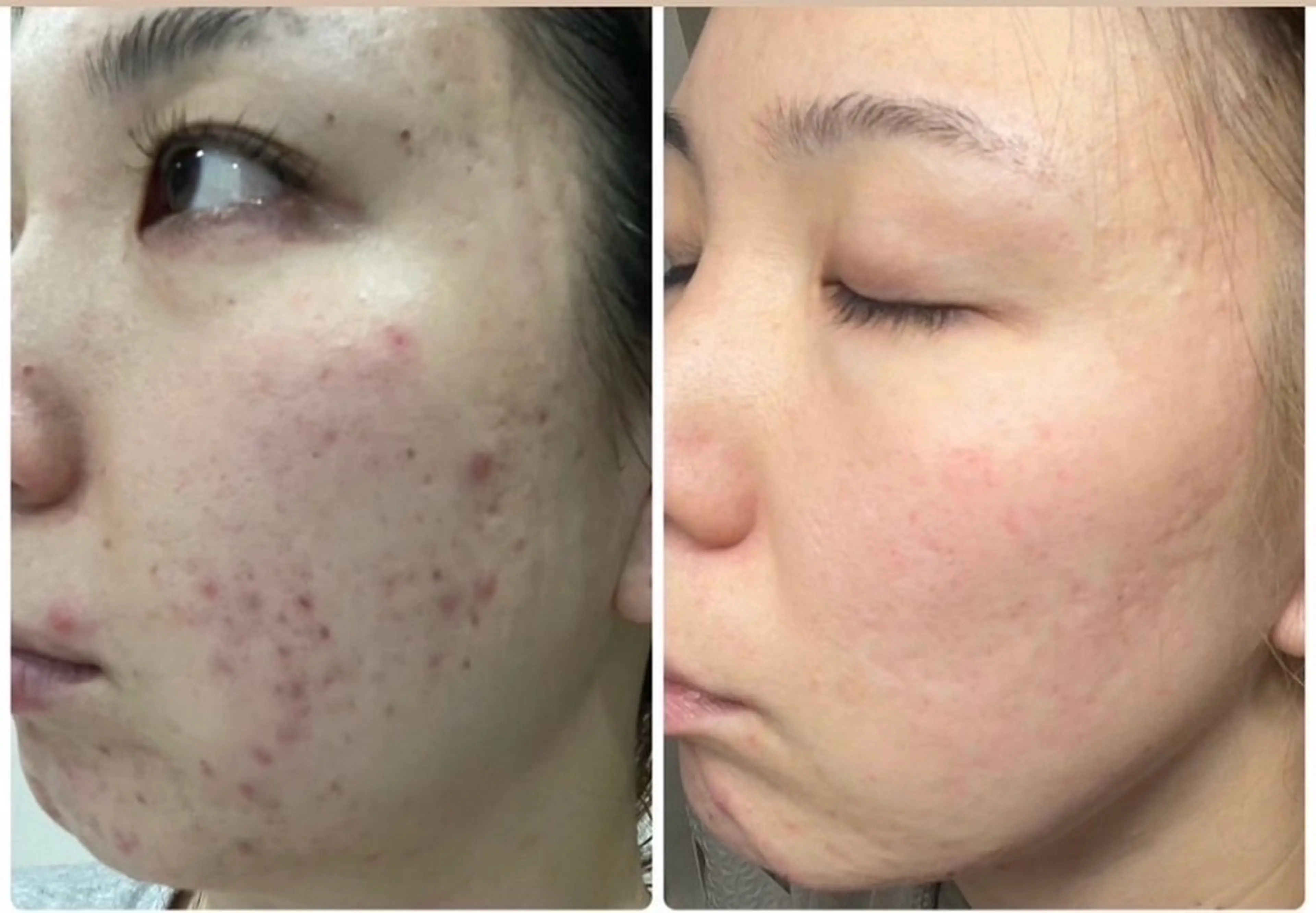 Yosapark CARNAのエステ・リラクイメージ