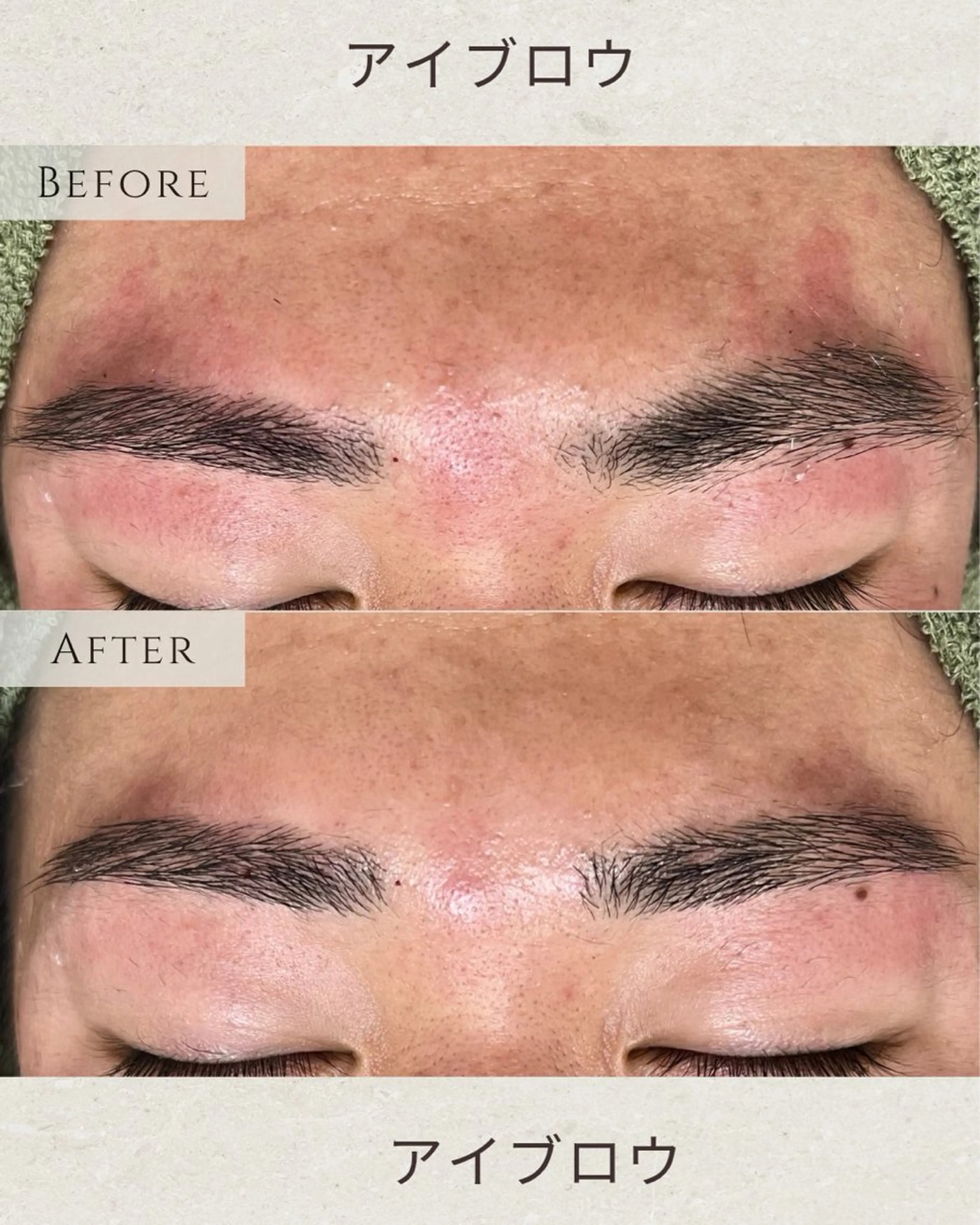 アイブロウ ワックス脱毛 眉カット その他(アイブロウ) シミ毛穴ケア EsteAのエステ・リラクイメージ