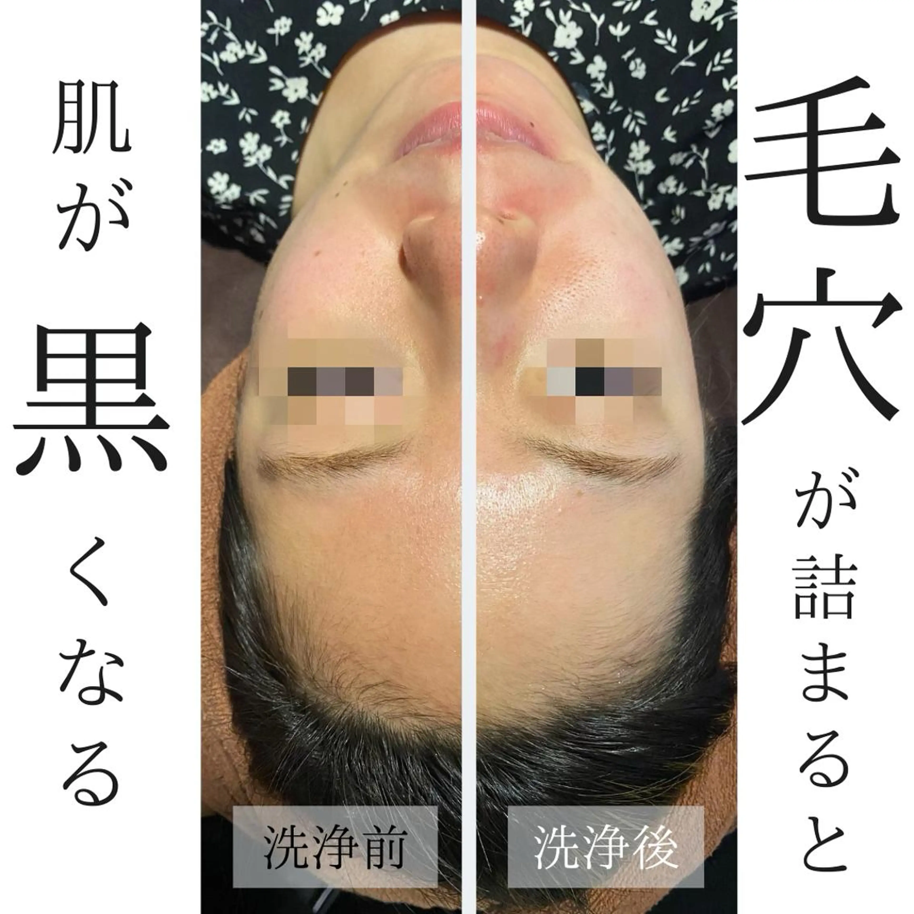 ハーブピーリング・毛穴ケア専門サロンSalon de LENA所属・ハーブピーリング 専門店/名古屋駅前店のエステ・リラクイメージ