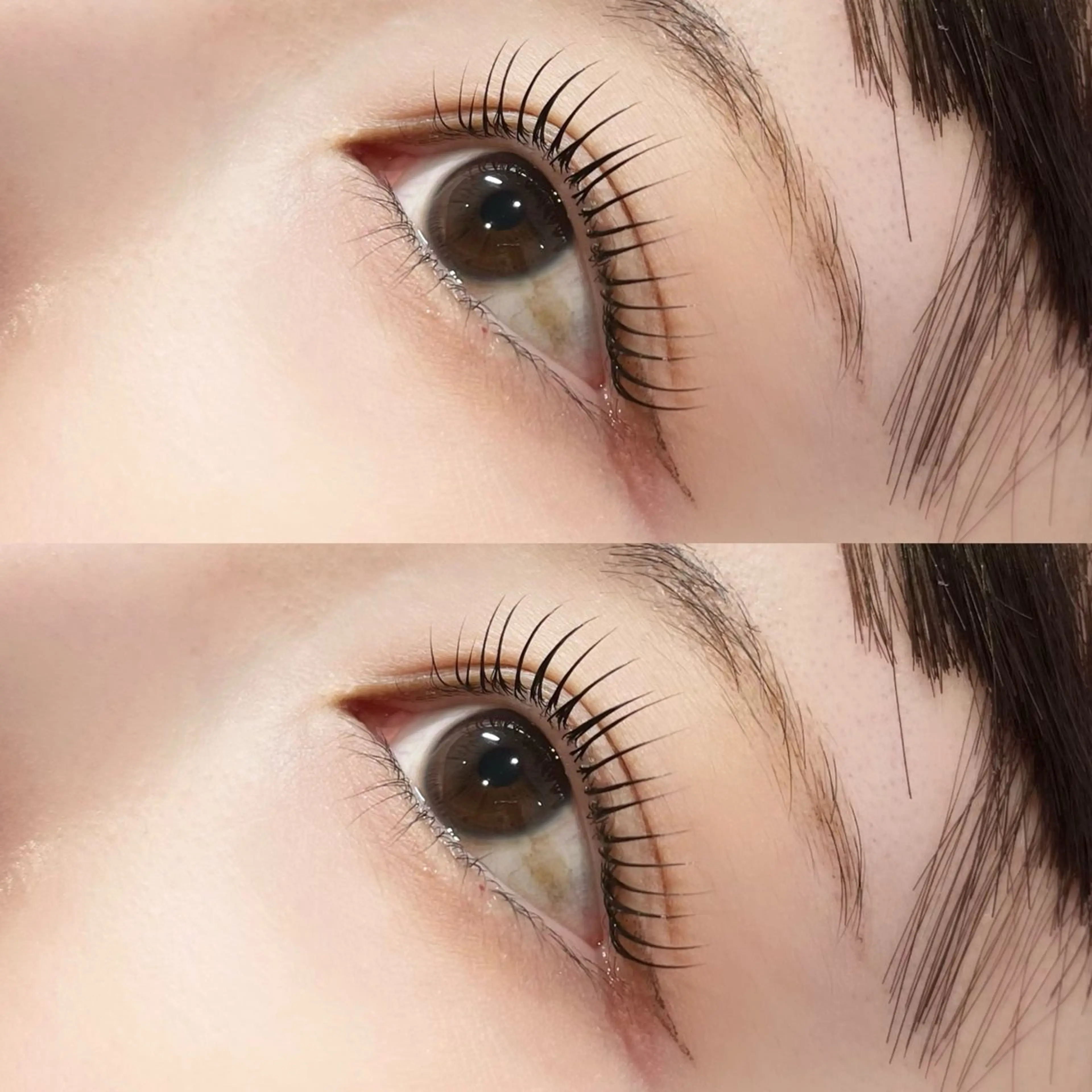 ใใใจใฏใปใใใ ๐๐๐๐๐ ๆ่ฑใฎใใใจใฏใปใใใใใถใคใณ