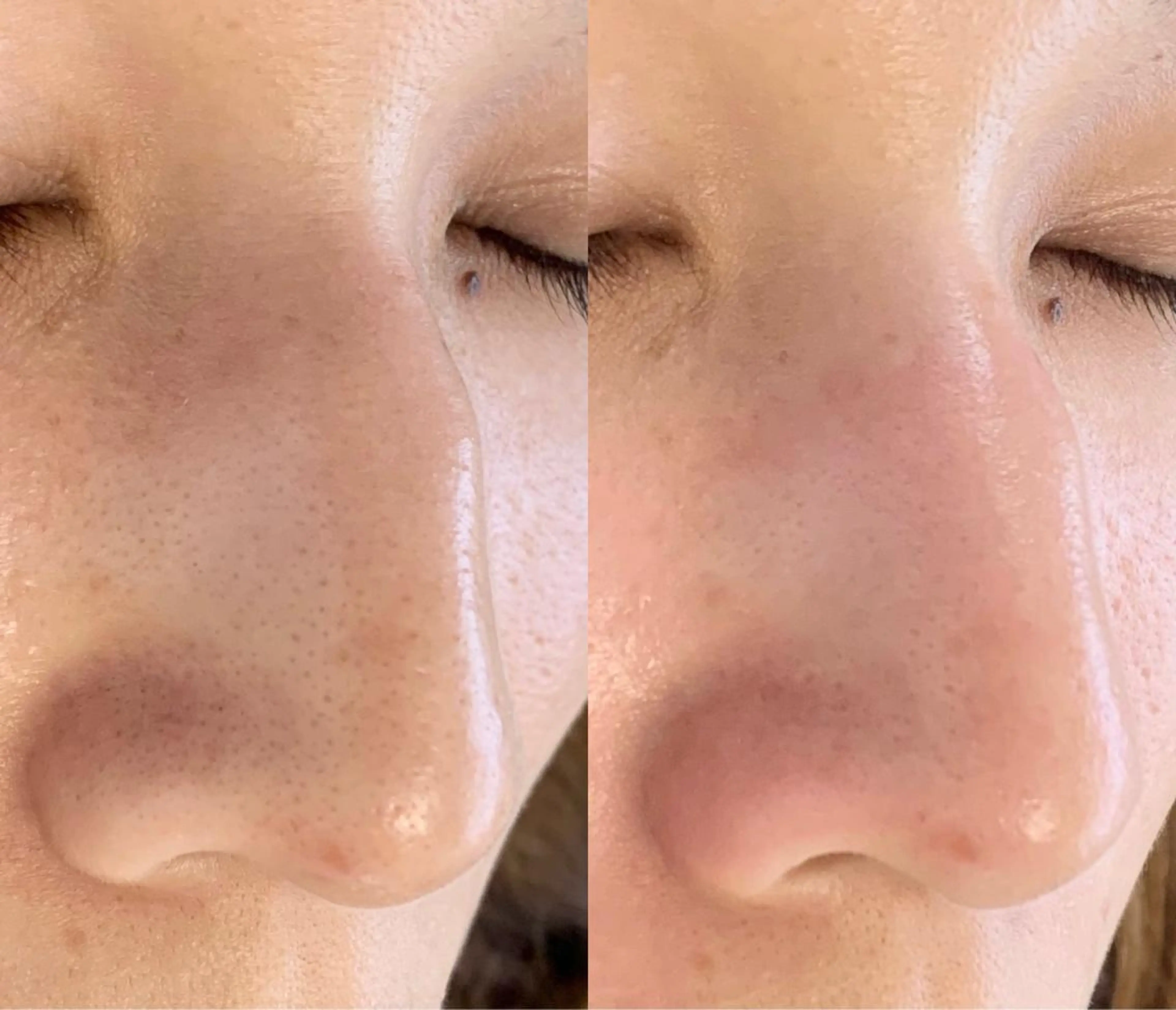 メンズ エステ salonLADYSTYLE所属・稲嶺 美華のエステ・リラクイメージ