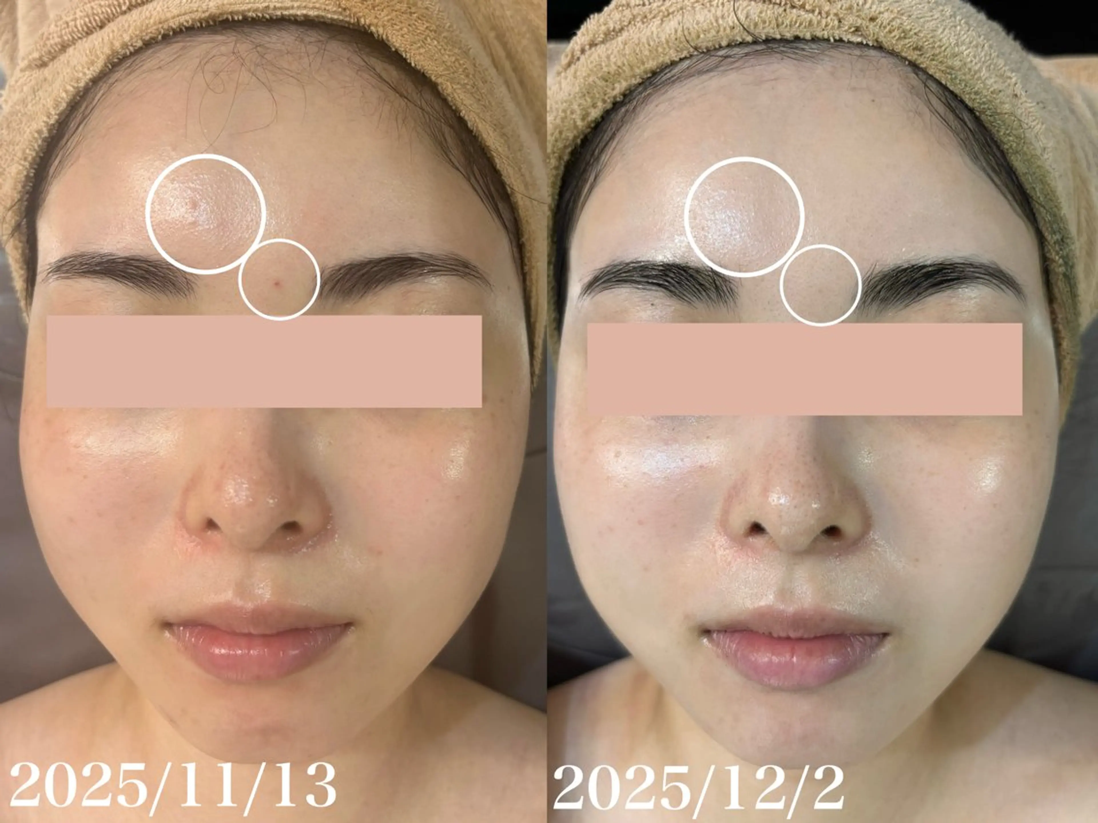 エステ WHITE AQUA 北千住店のエステ・リラクイメージ