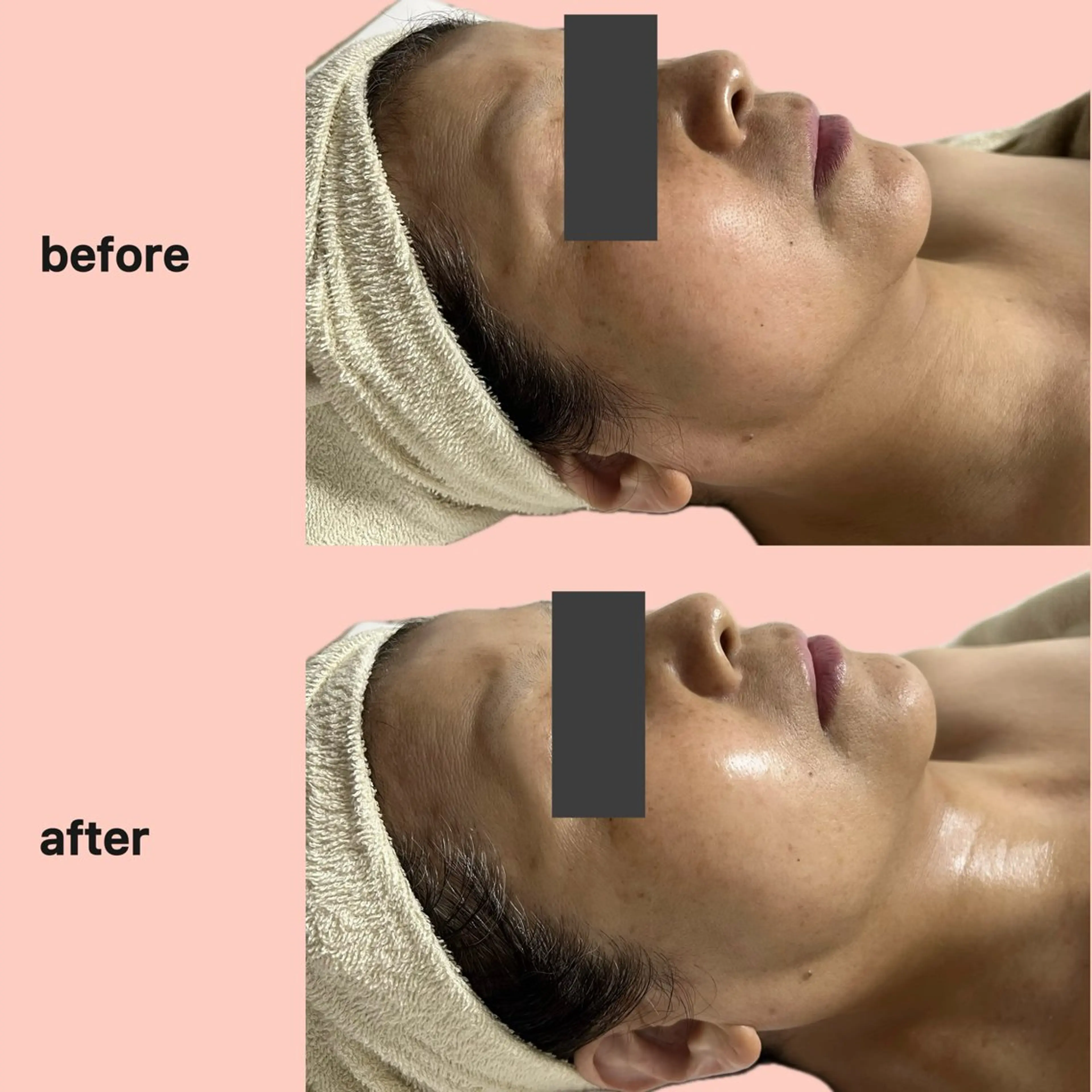 エステ gleam ü 枚方公園のエステ・リラクイメージ