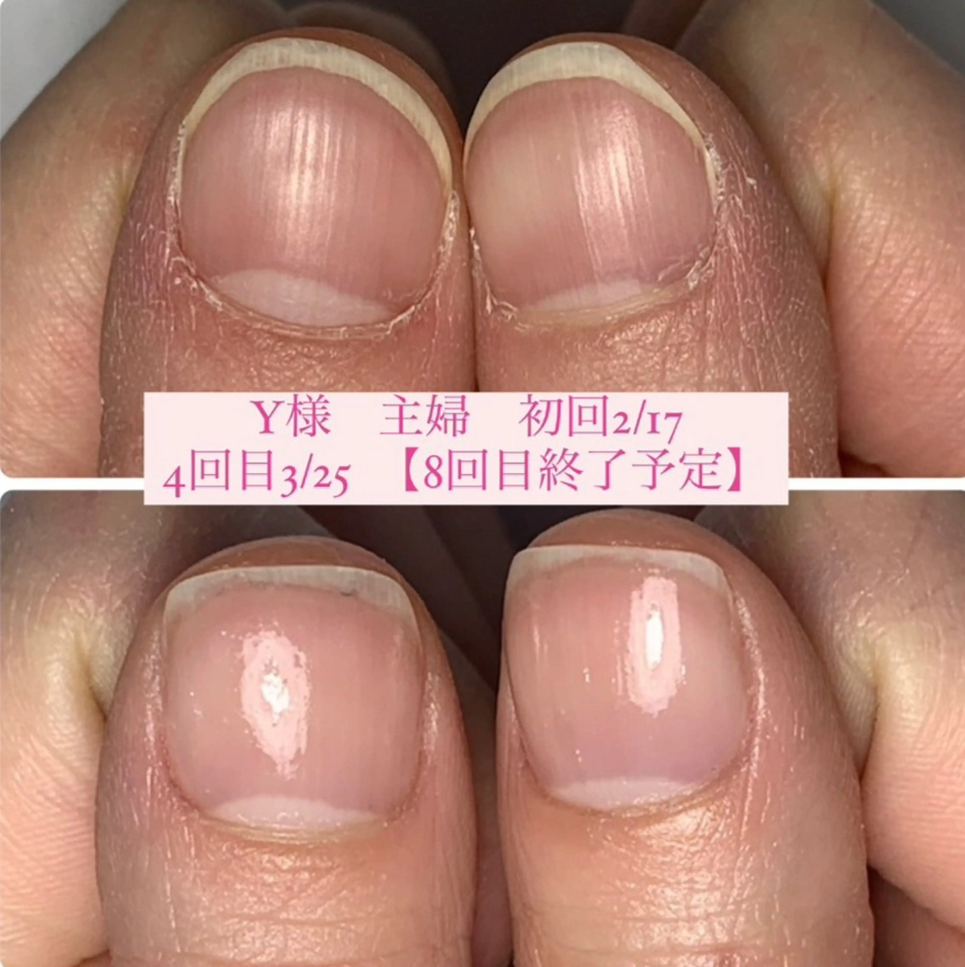ネイル ジェルネイル ハンドケア AKT NAIL所属・AKT Beauty エステヘッドスパのエステ・リラクイメージ
