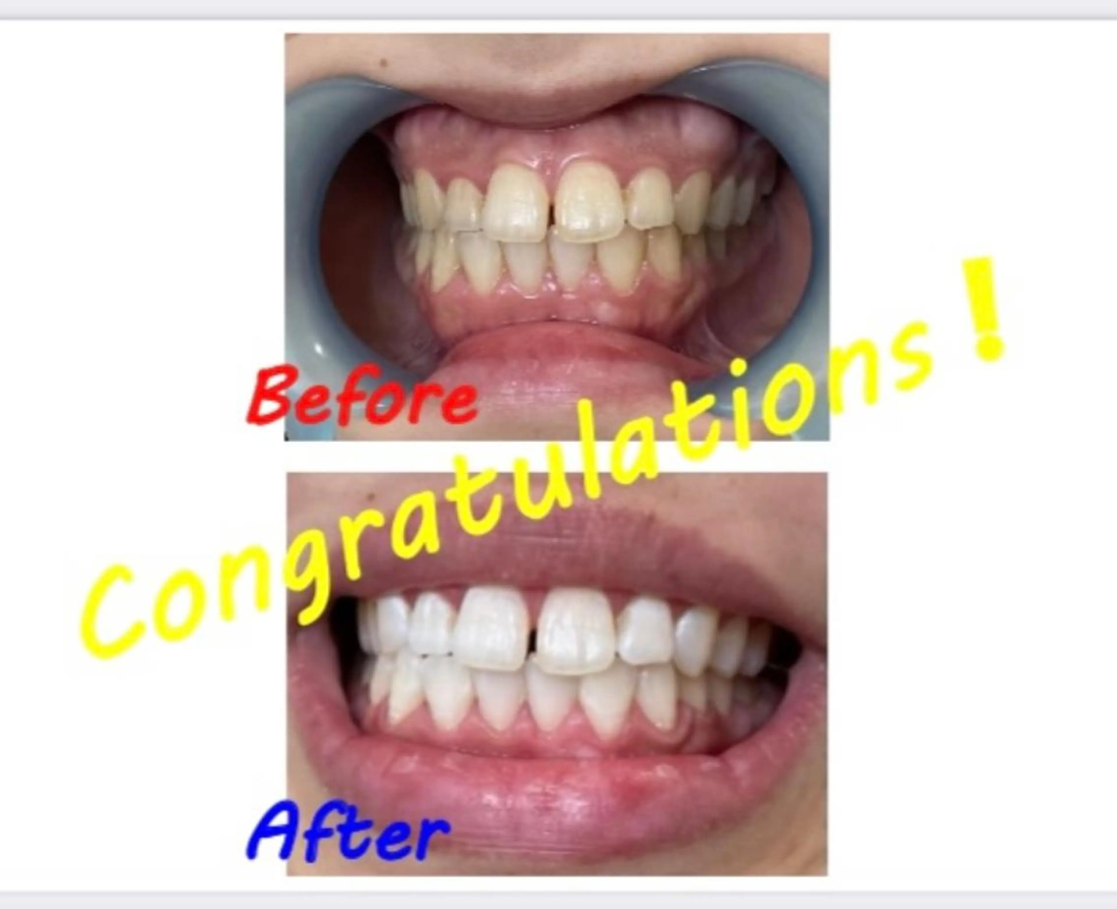 その他 セルフホワイトニングサロン　ラヴィアン所属・ホワイトニングサロン La vie enのその他イメージ