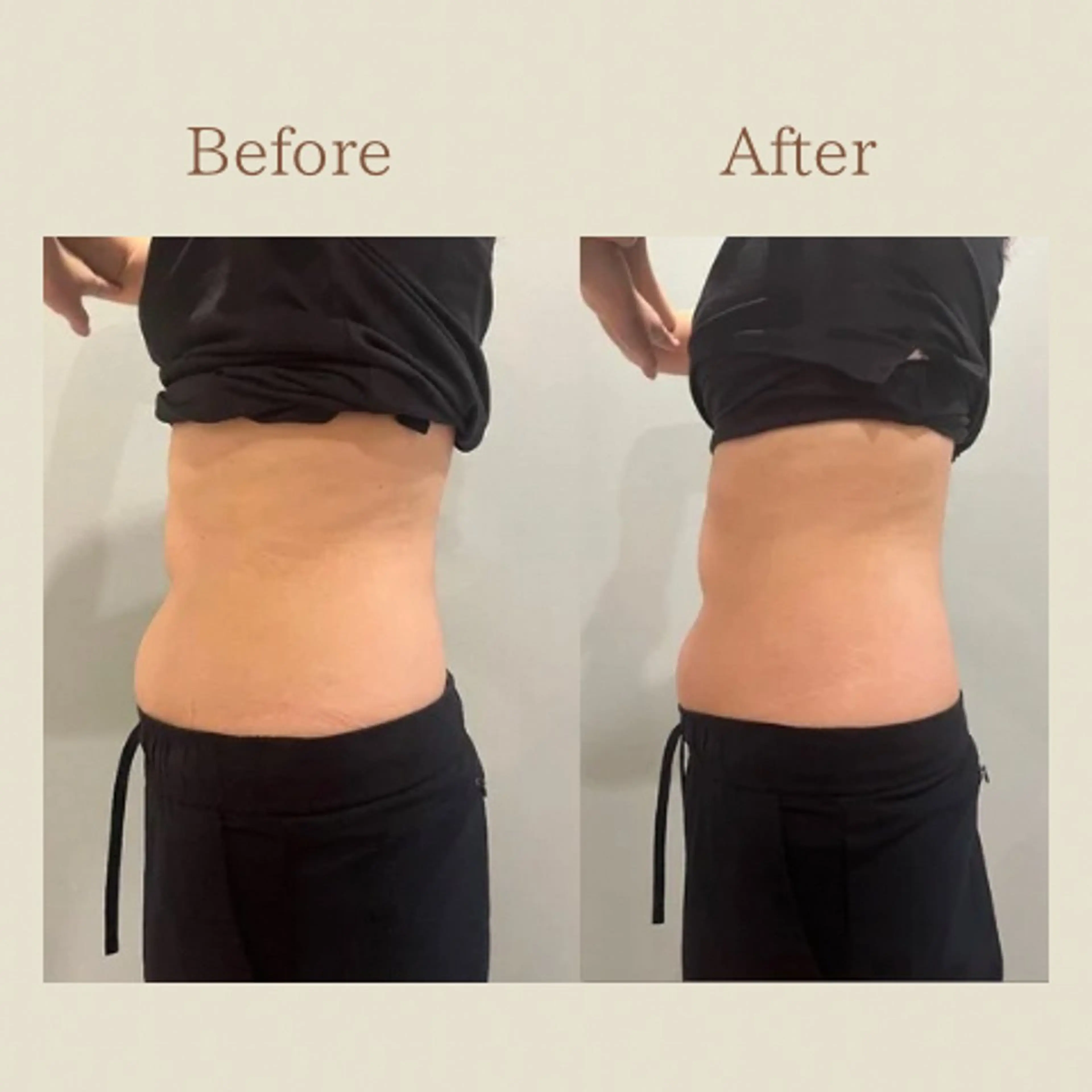 お腹痩せエステ Flat BELLY 恵比寿所属・【腸もみ/脂肪冷却】 お腹エステ/恵比寿のエステ・リラクイメージ
