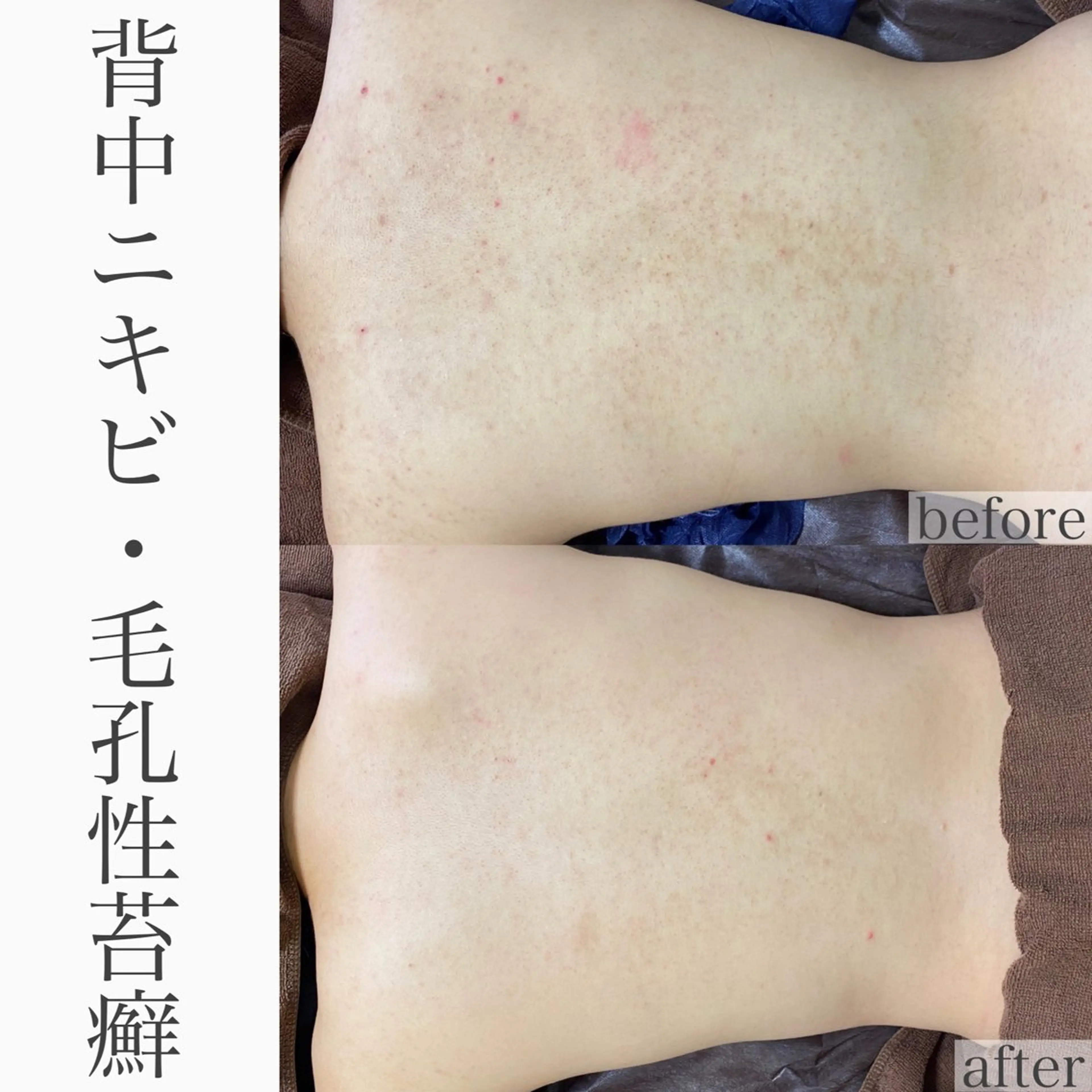 エステ ハーブピーリング専門 BIOEL横浜のエステ・リラクイメージ