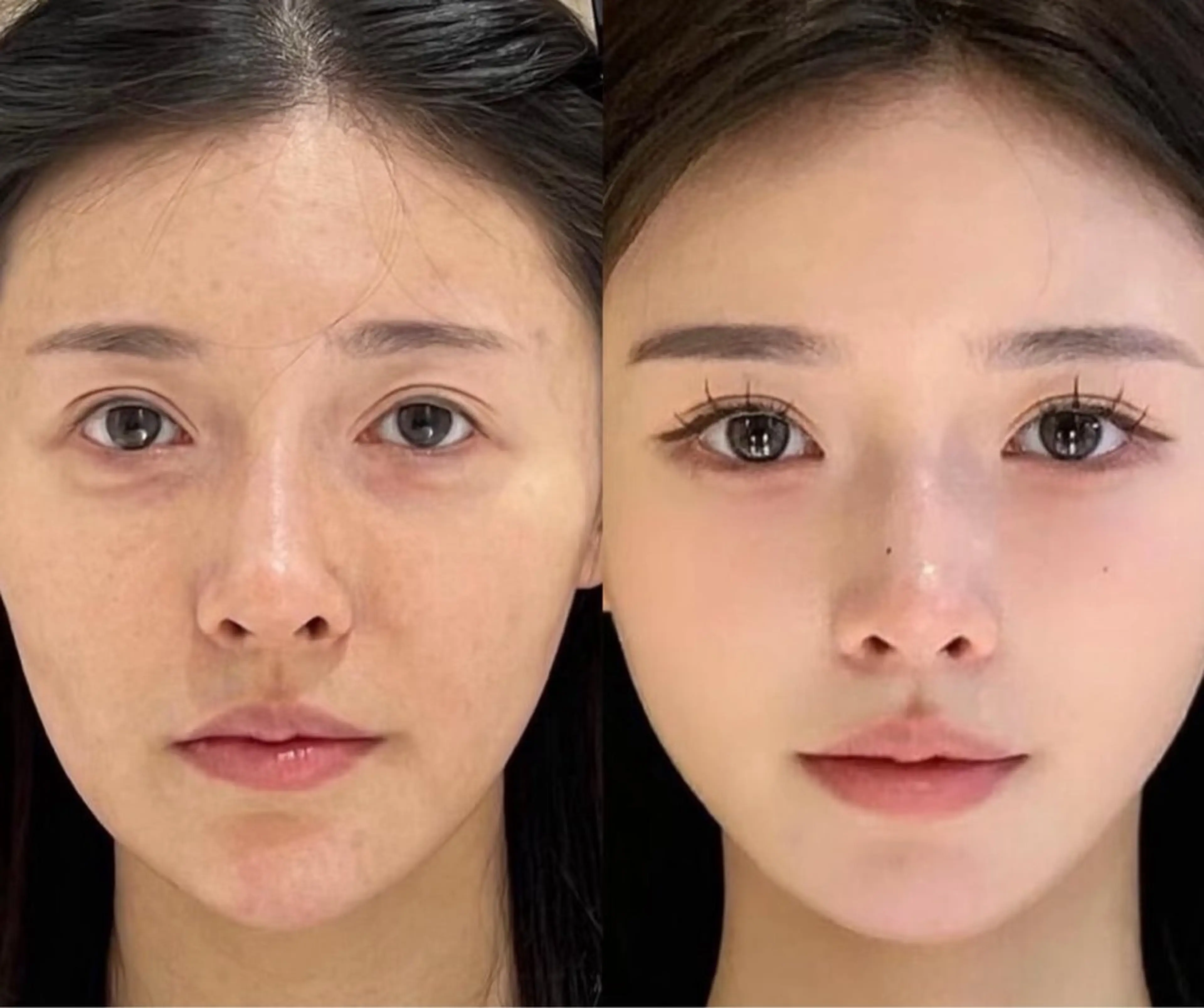ネイル エステ aliaハイフ&水光ジェットサロン所属・aliaハーブ水光店 エステティシャン募集のエステ・リラクイメージ