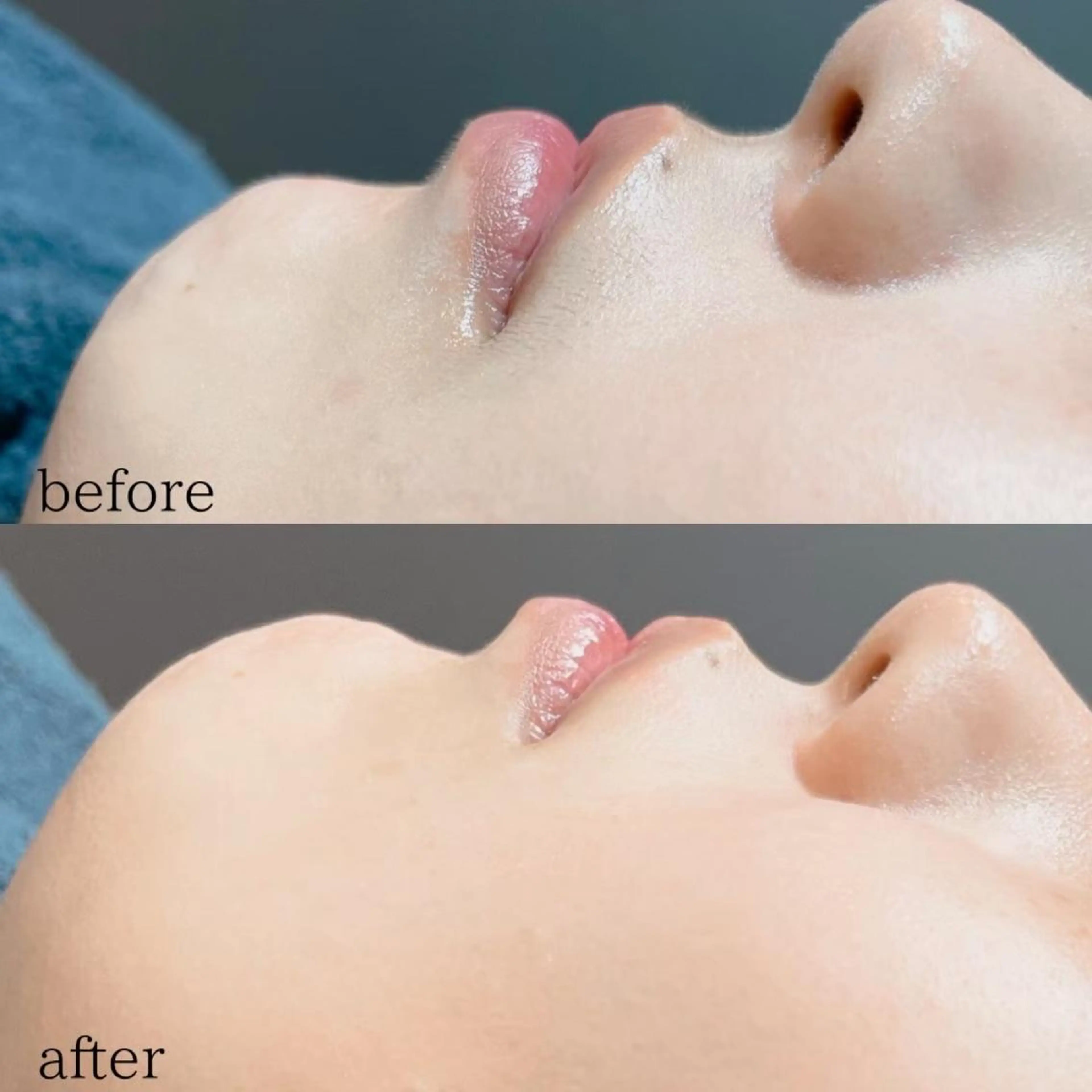 🫧美しい素肌へ🫧 今成柚乃のその他イメージ