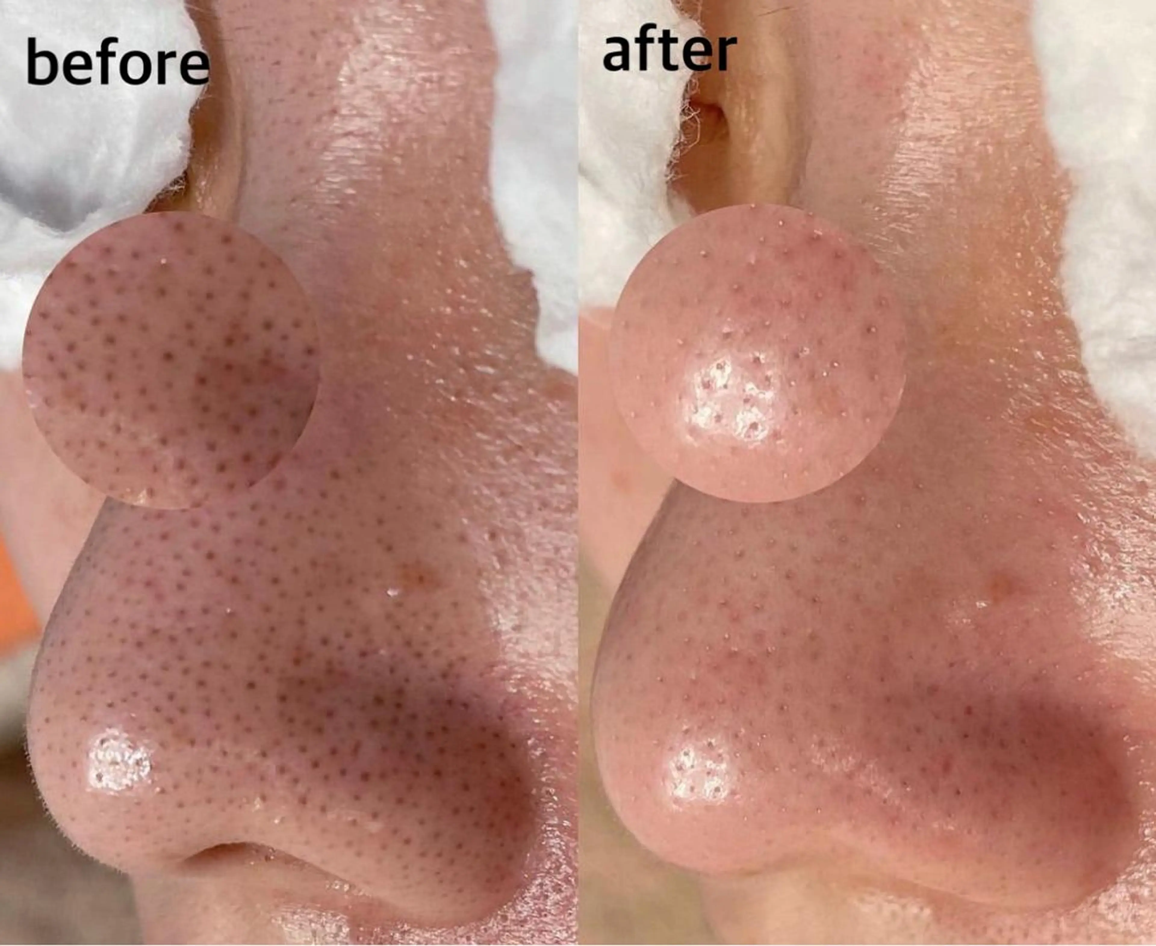 韓国肌管理 【毛穴専科】のエステ・リラクイメージ