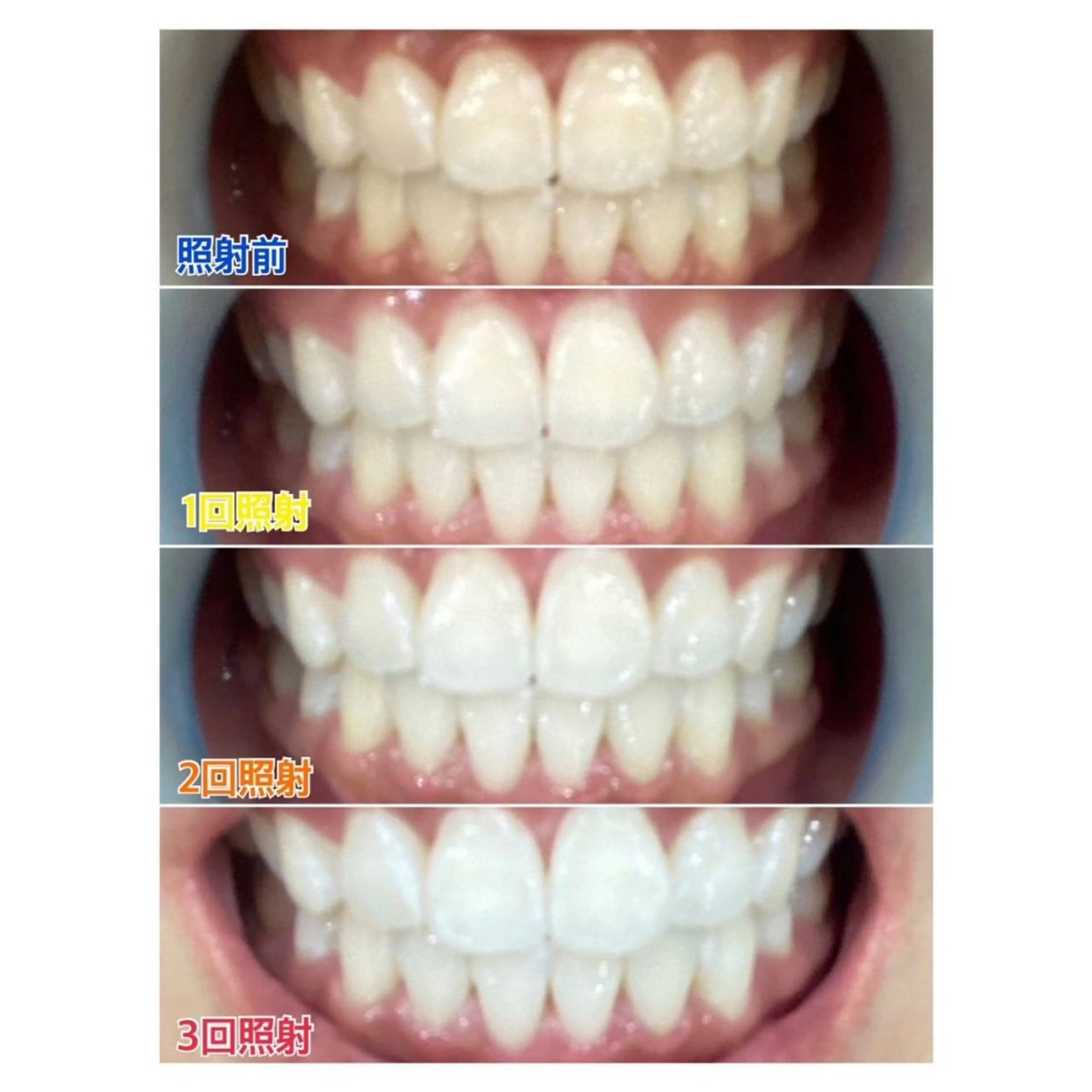 MBEAUTYSALON 千葉店・京成大久保所属・Melty 輝のその他イメージ