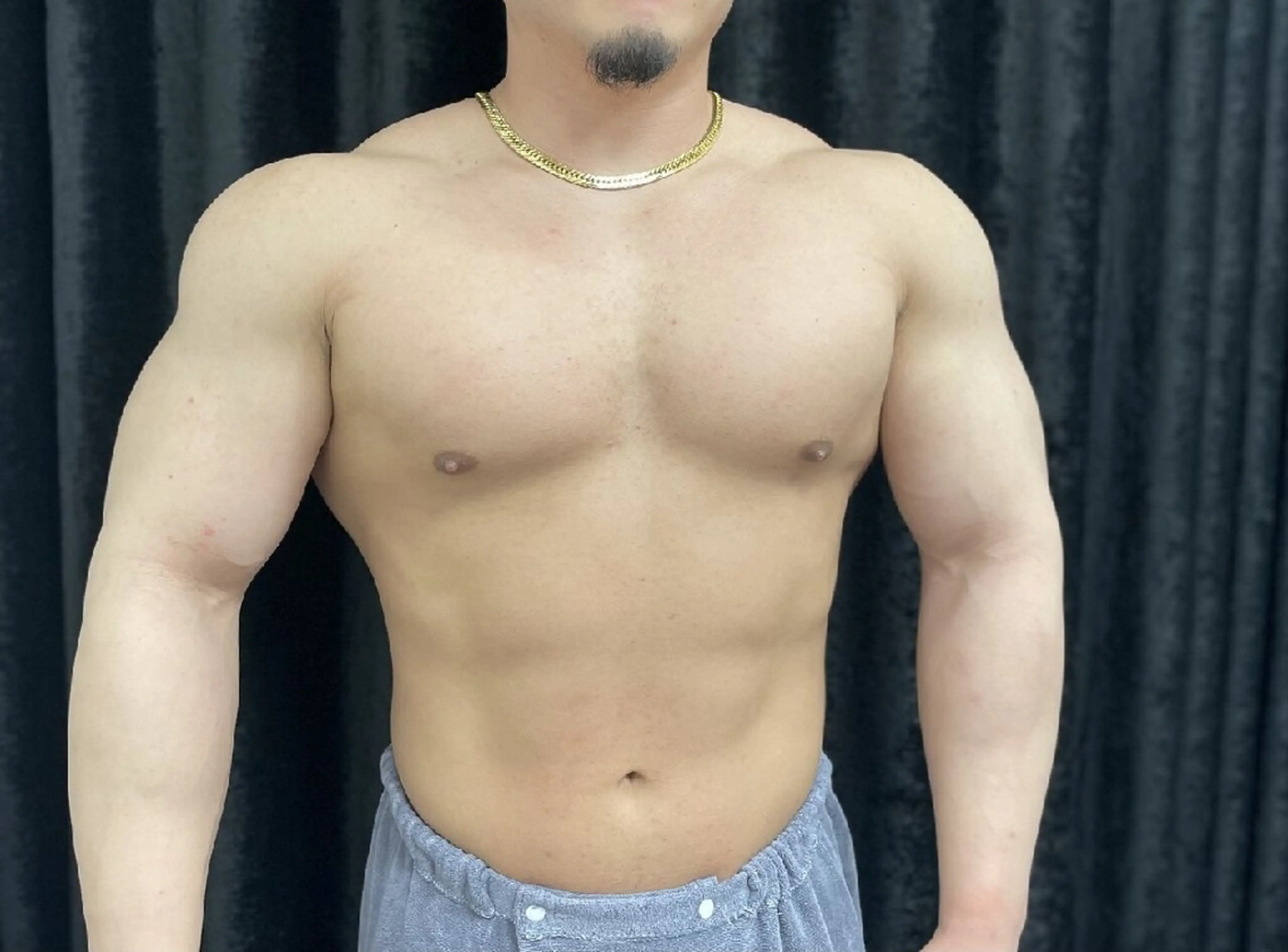 メンズ全身脱毛🌈(顔あり･VIOあり)保湿パック付き😎の写真