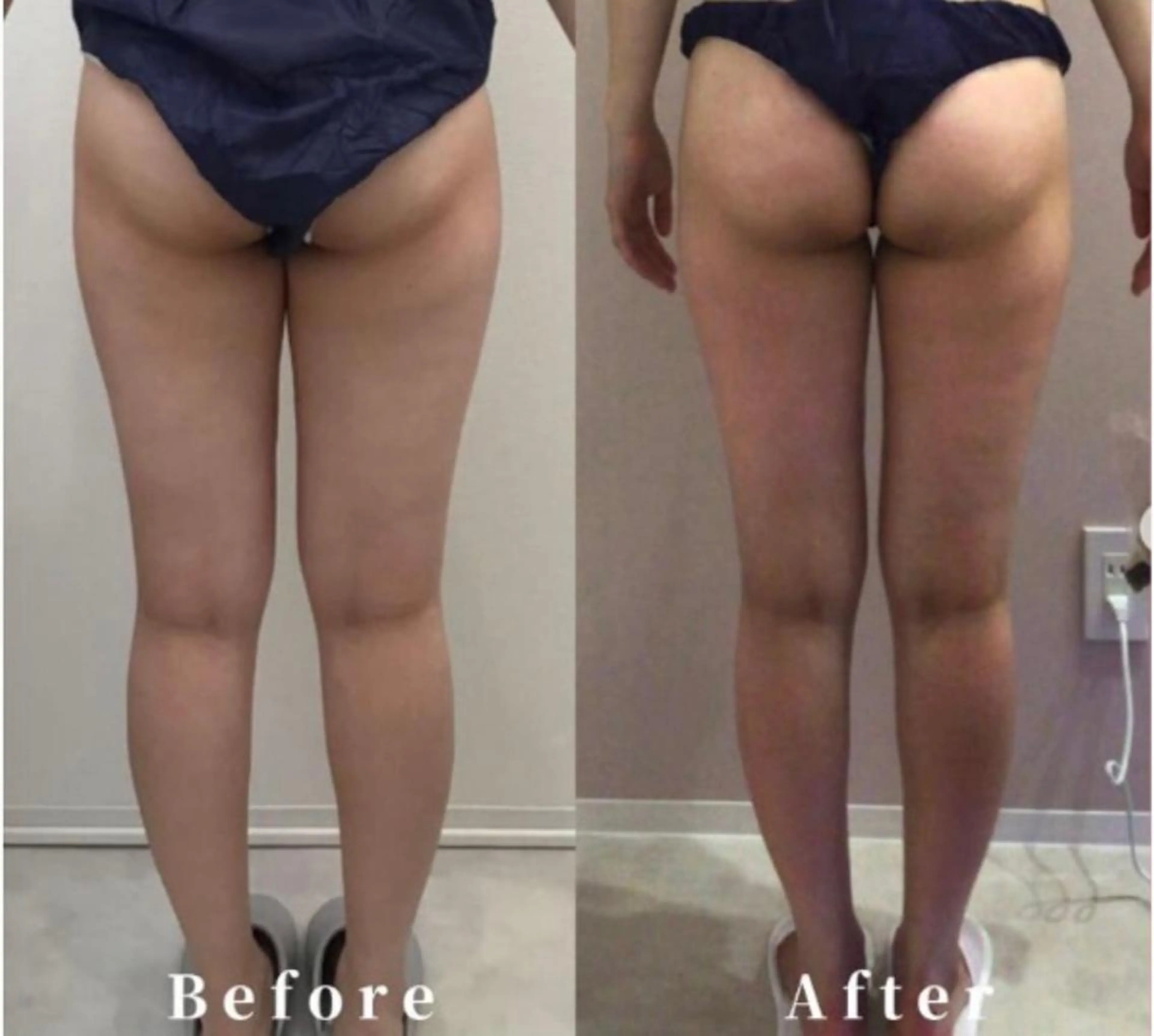 エステ beautysalon SAKUセンター南所属・ビューティーサロン SAKU センター南のエステ・リラクイメージ