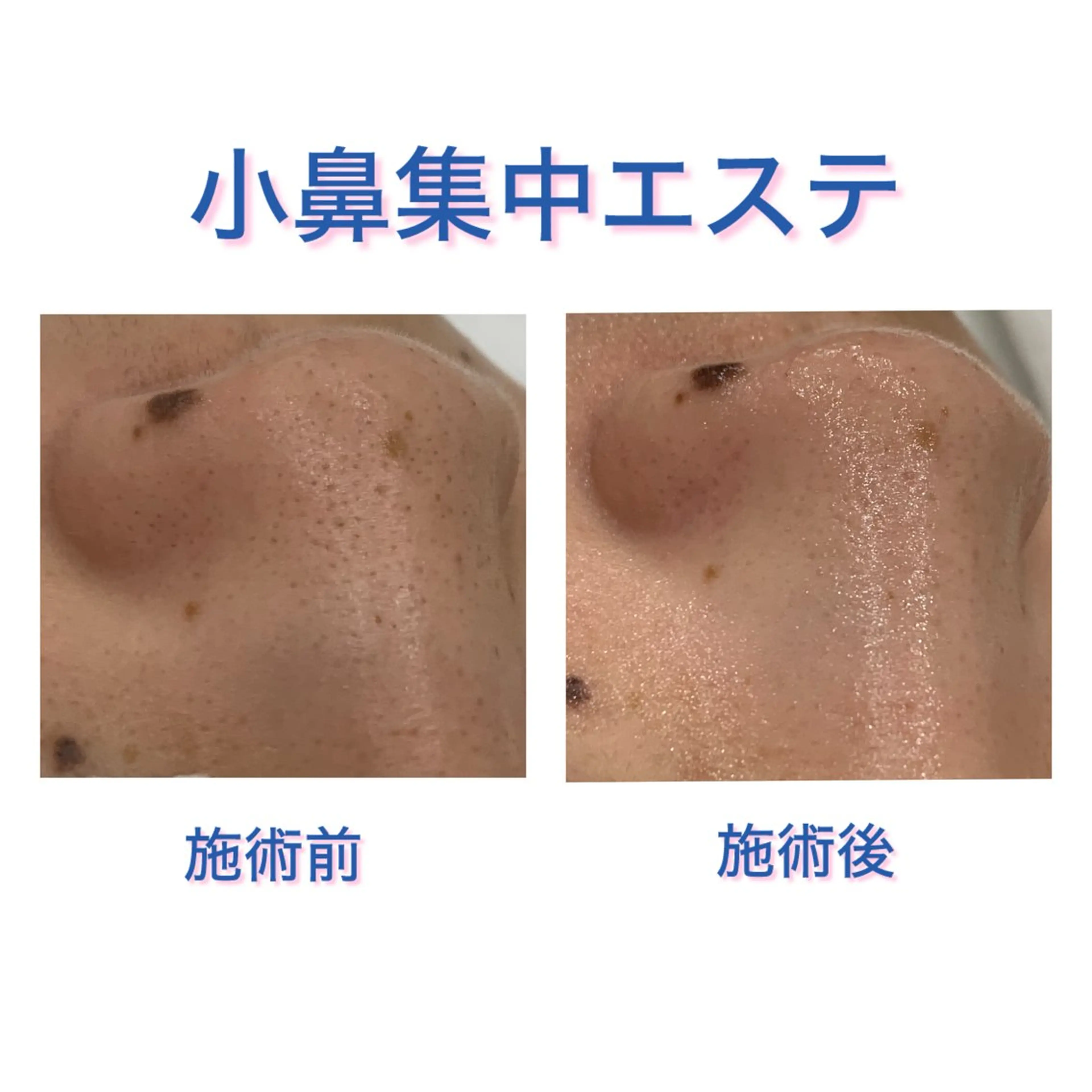 DeI’m我孫子店所属・安原 菜々子のエステ・リラクイメージ