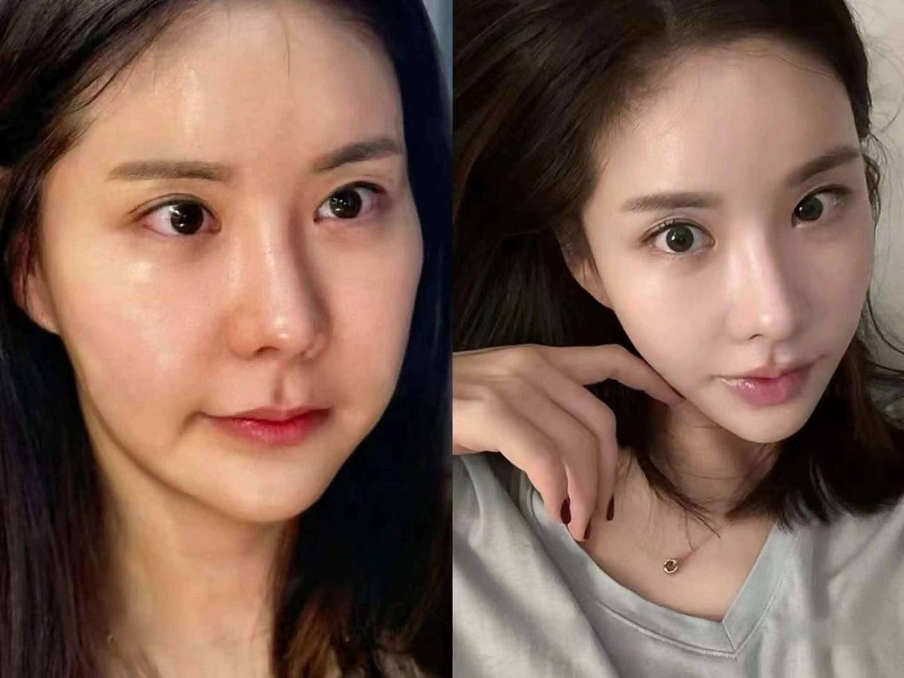 ネイル エステ aliaハイフ&水光ジェットサロン所属・aliaハーブ水光店 エステティシャン募集のエステ・リラクイメージ