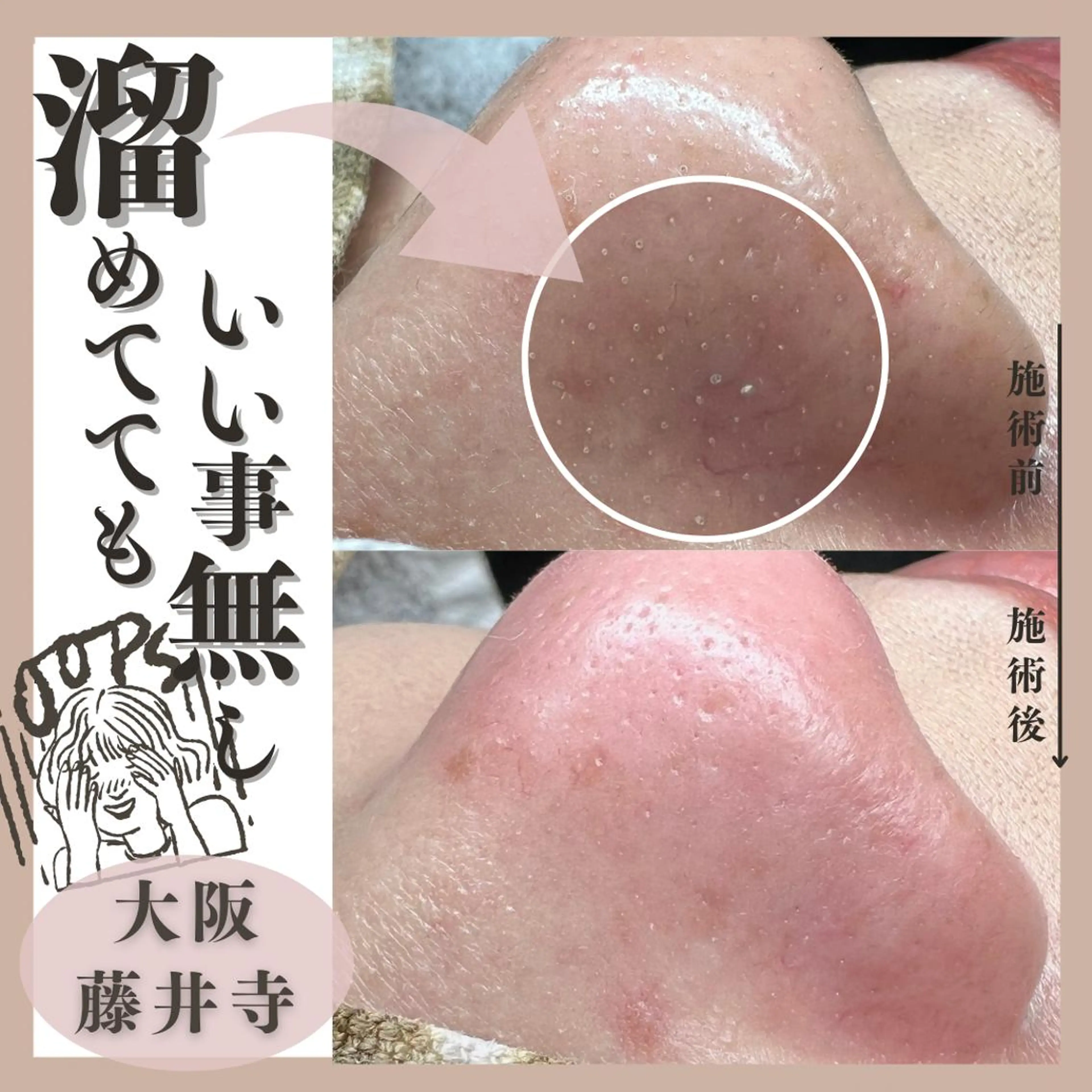 Muqu.所属・Muqu. 毛穴サロンのエステ・リラクイメージ