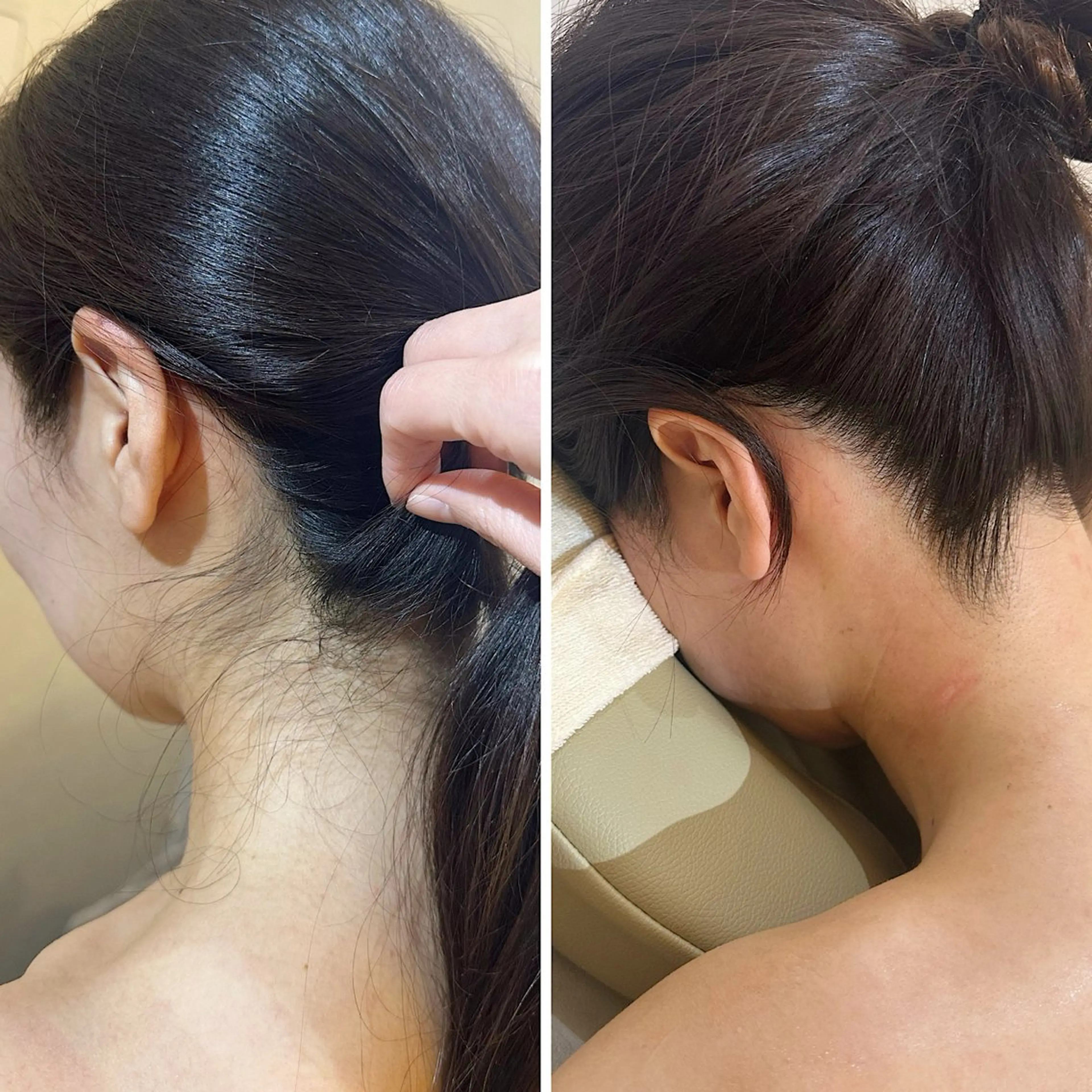 脱毛 うなじ脱毛/美肌脱毛 LABELのエステ・リラクイメージ