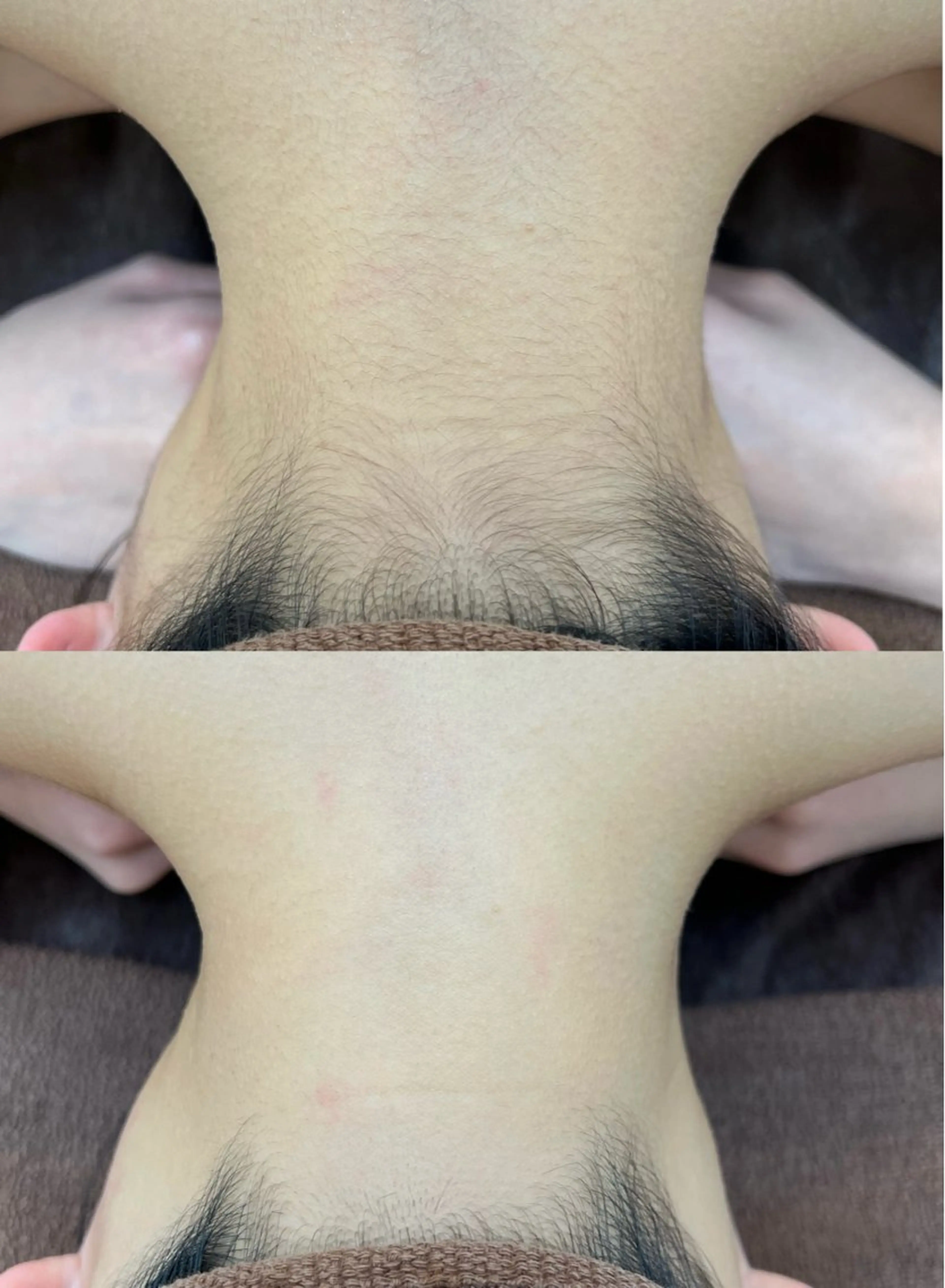 脱毛 プライベートサロン リプレイスのエステ・リラクイメージ