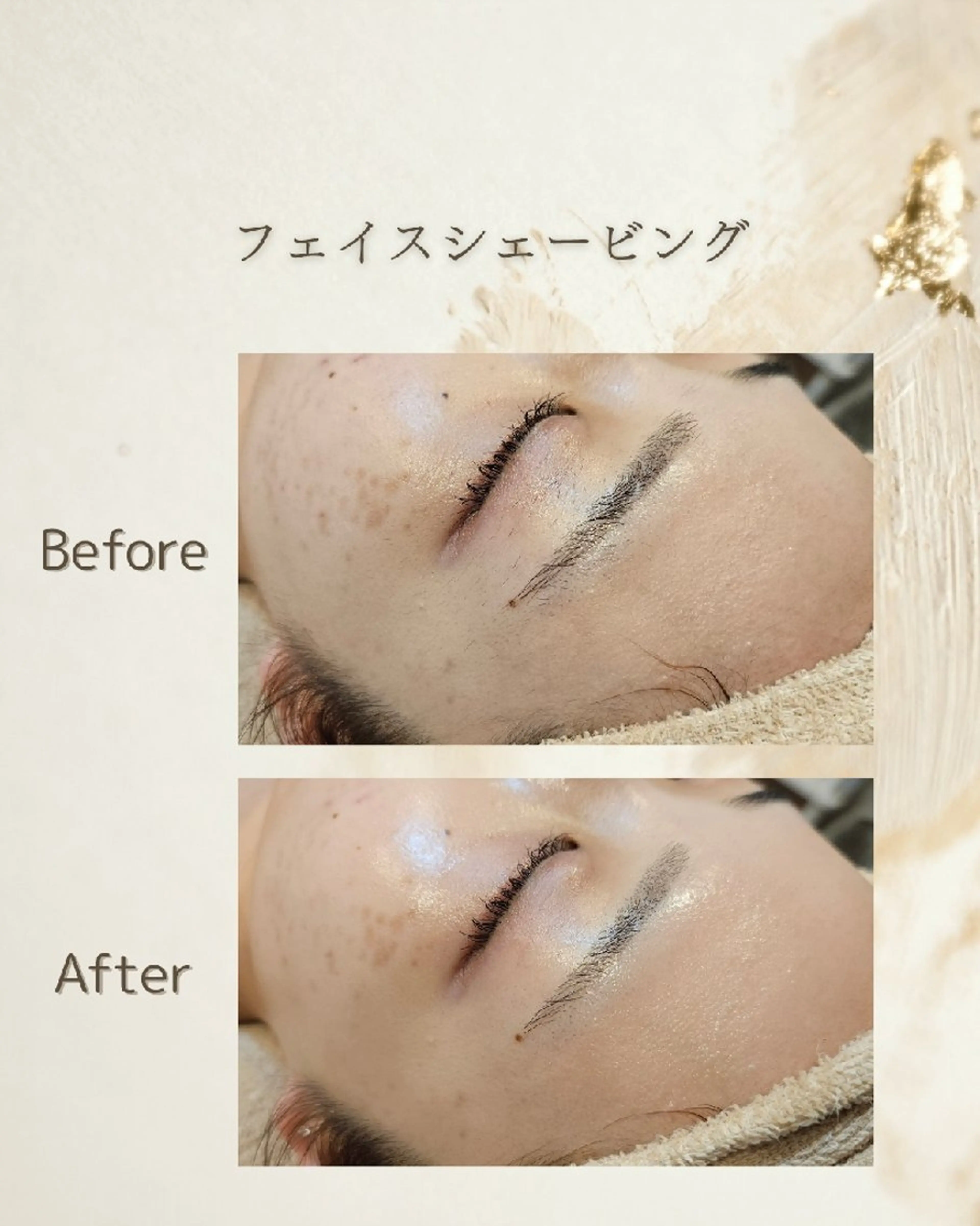 【顔】フェイスシェービング&アクティベーターの写真