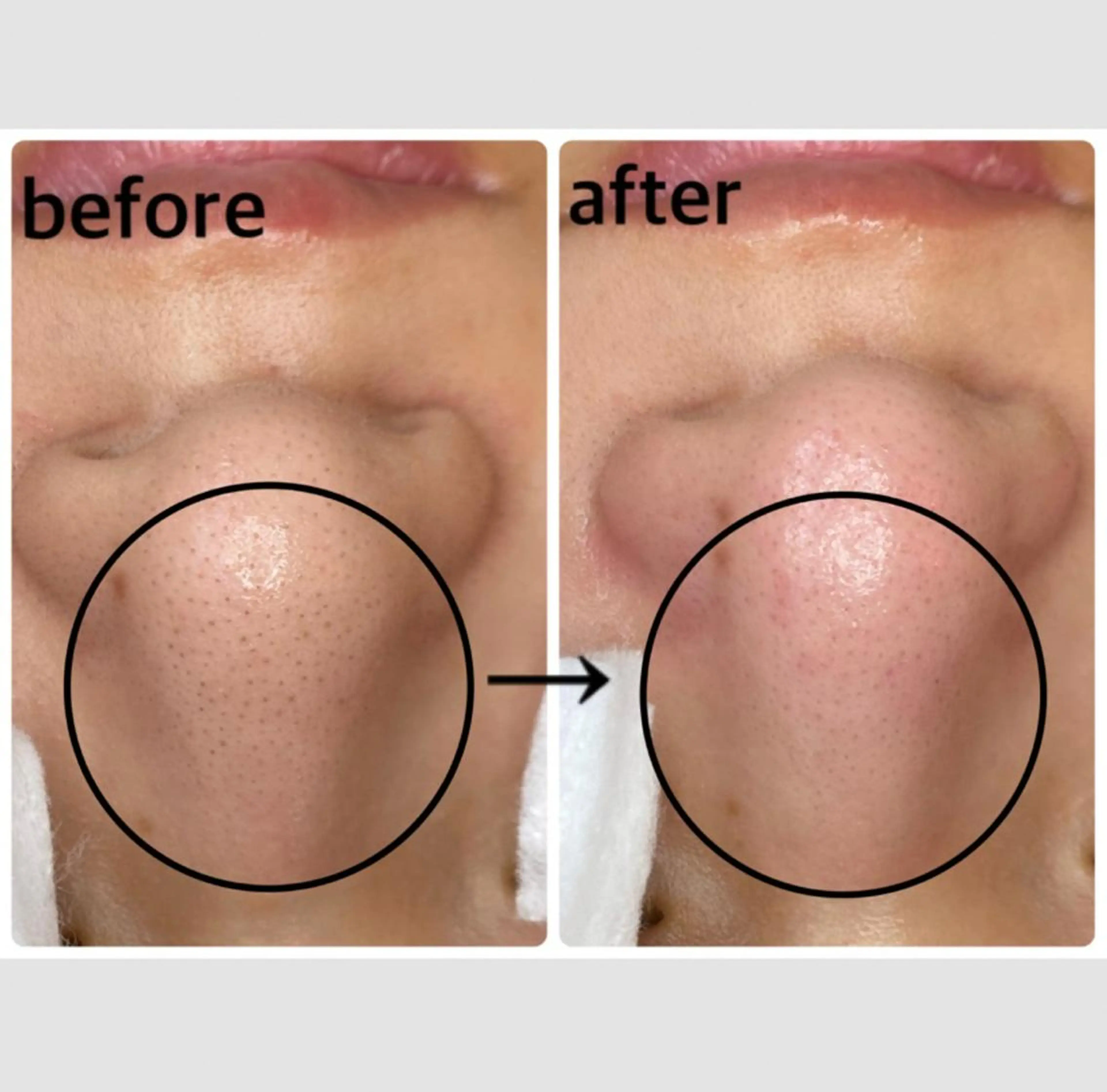 マツエク・マツパ エステ リラク 韓国肌管理 【毛穴専科】のエステ・リラクイメージ