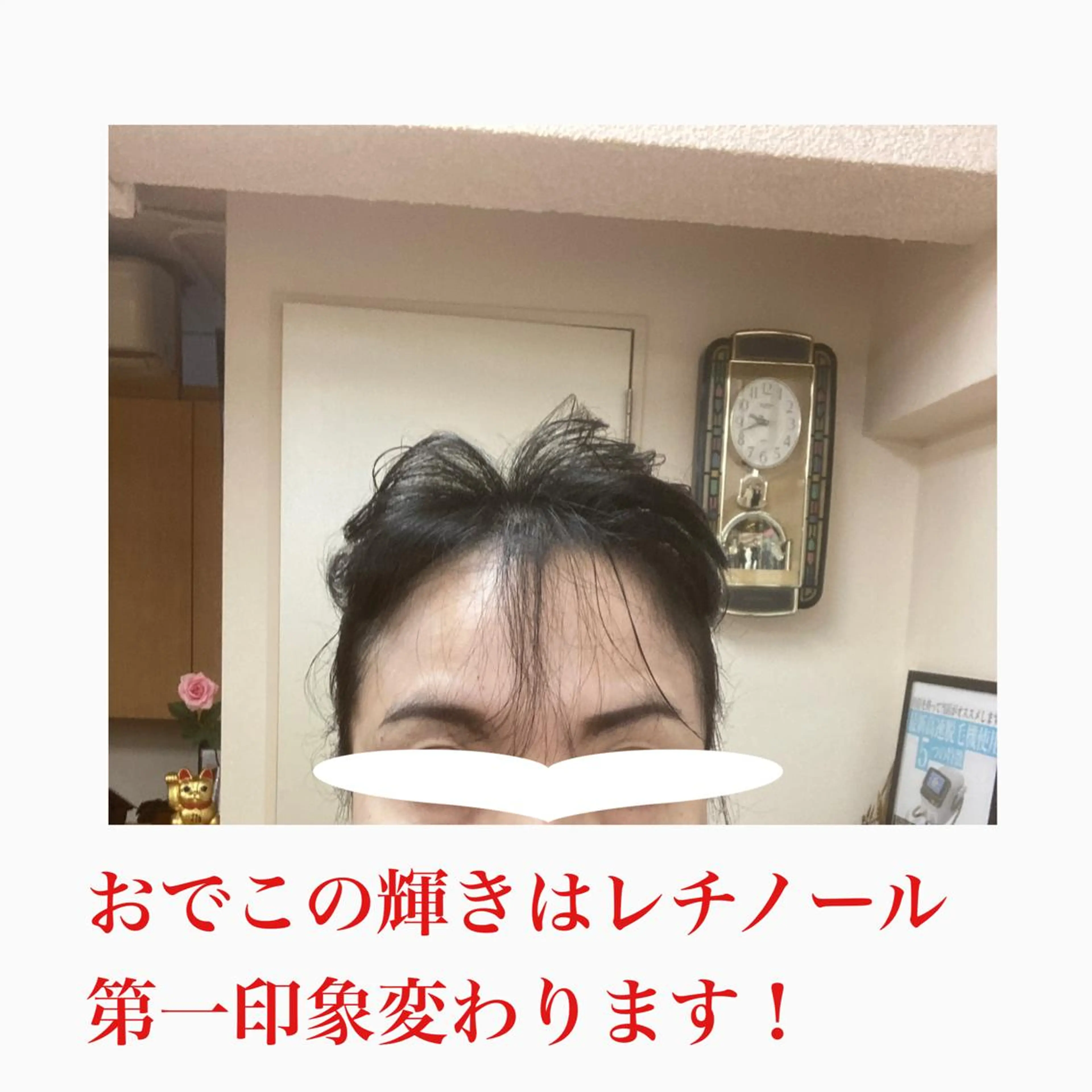オアシス・さくら所属・中村貴子都度払い脱毛 小顔コルギのエステ・リラクイメージ
