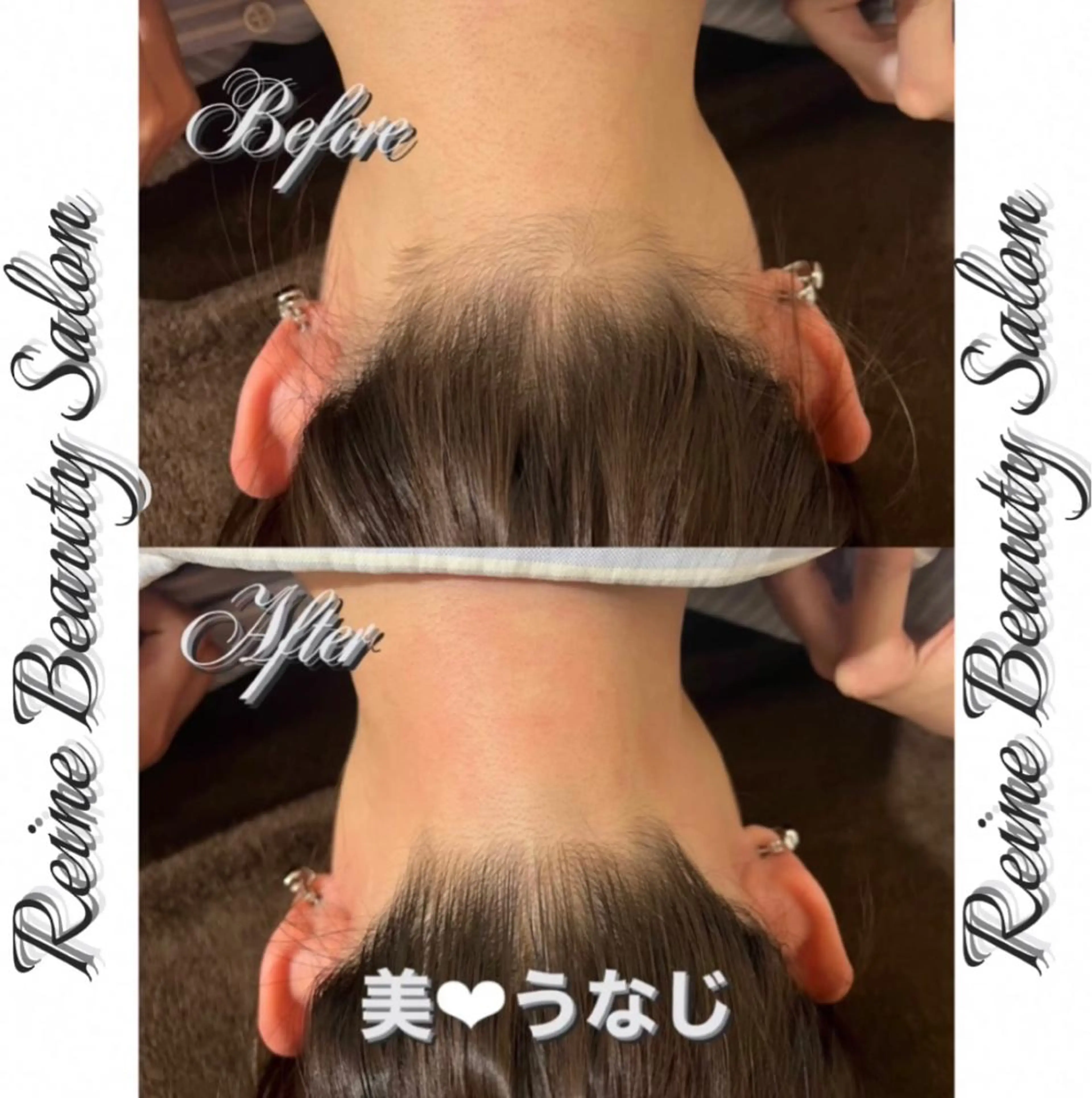 Reine BeautySalon所属・毛穴/シミ肝斑/脱毛 横山梨里のエステ・リラクイメージ
