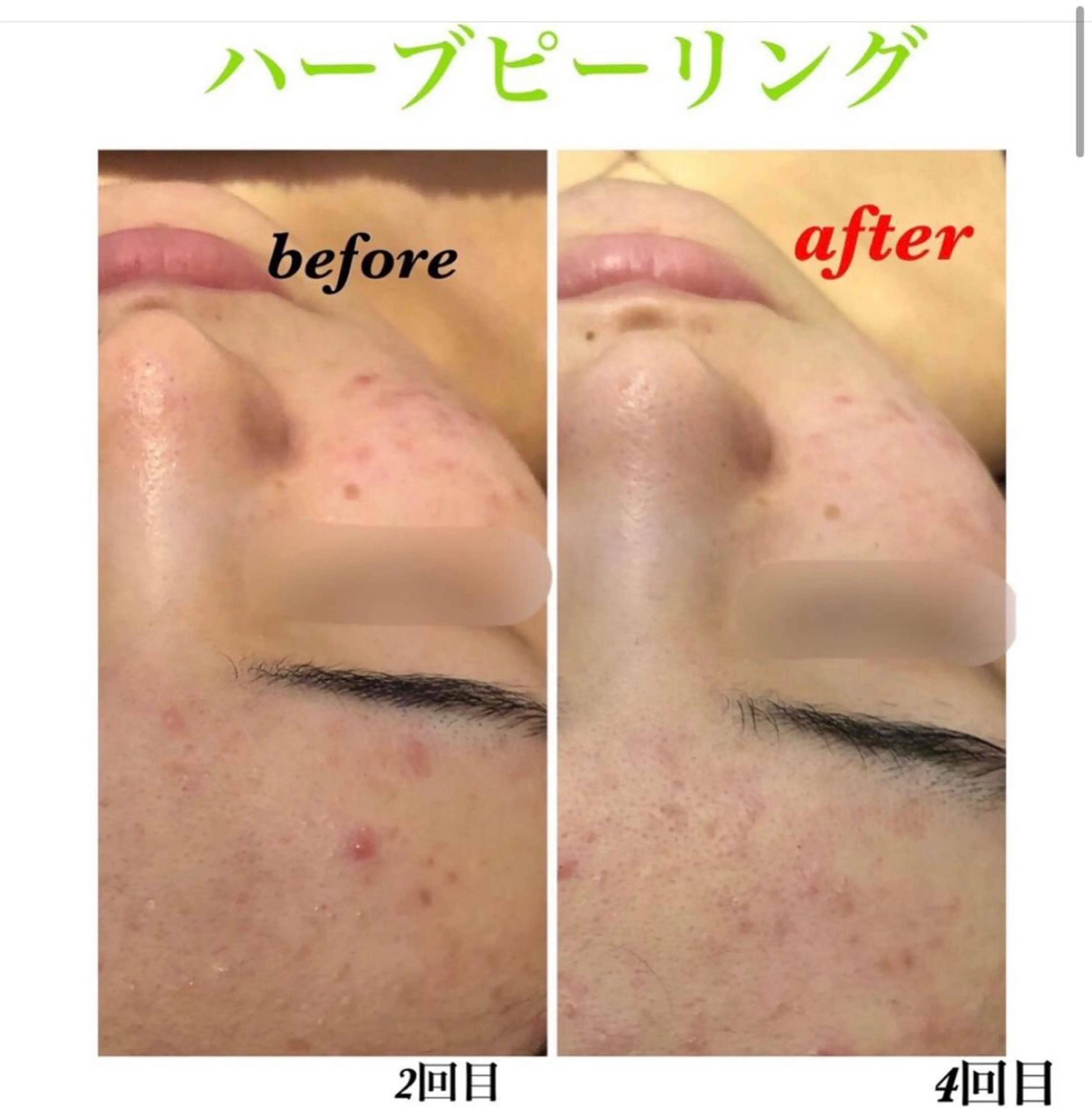 エステ 脱毛＆シェービング専門店　心斎橋所属・脱毛＆シェービング 専門店LUANAのエステ・リラクイメージ