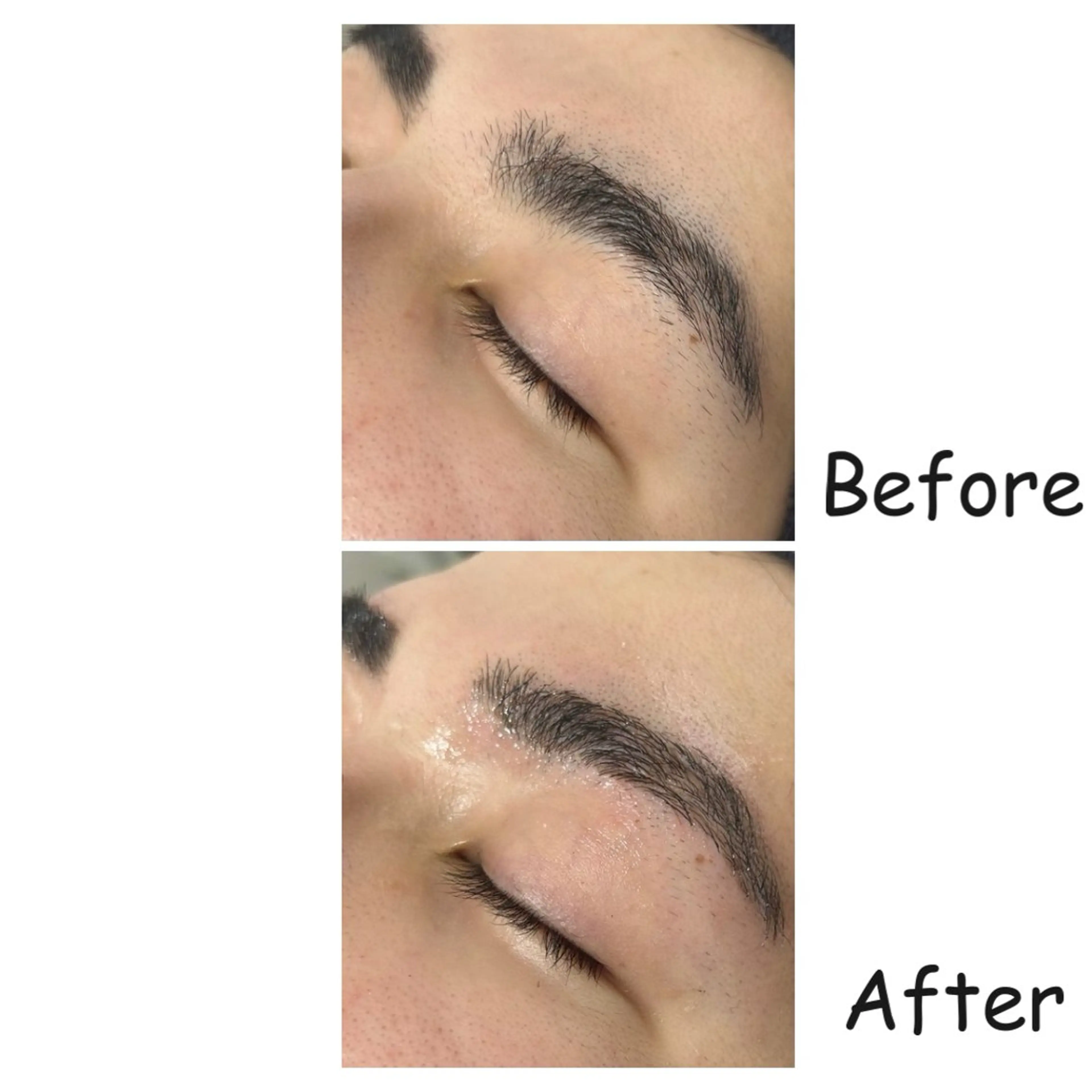 メンズ アイブロウ 眉毛ワックス脱毛 ワックス脱毛 エマニエル USAのその他イメージ