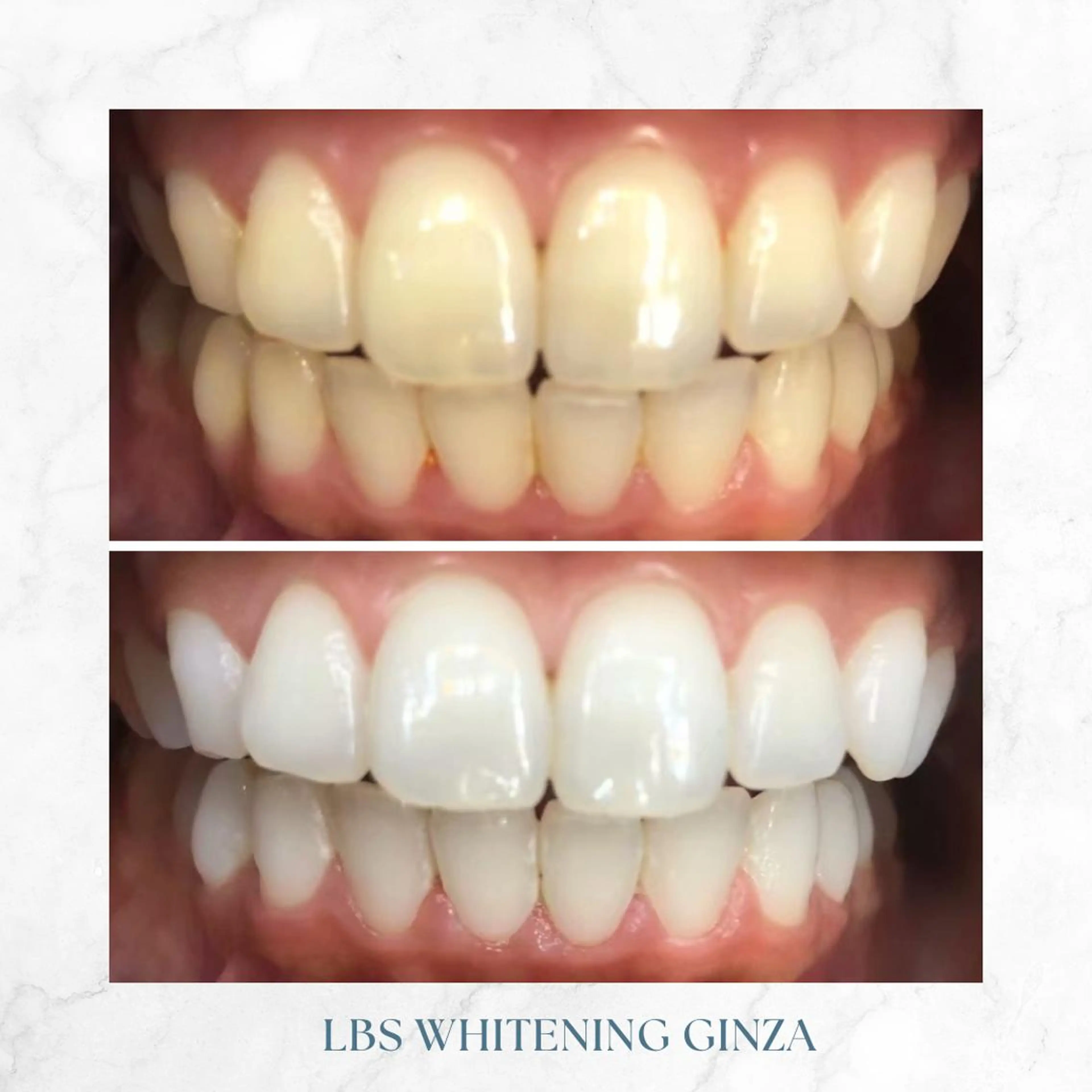 メンズ LBSホワイトニング 銀座店💎公式のその他イメージ