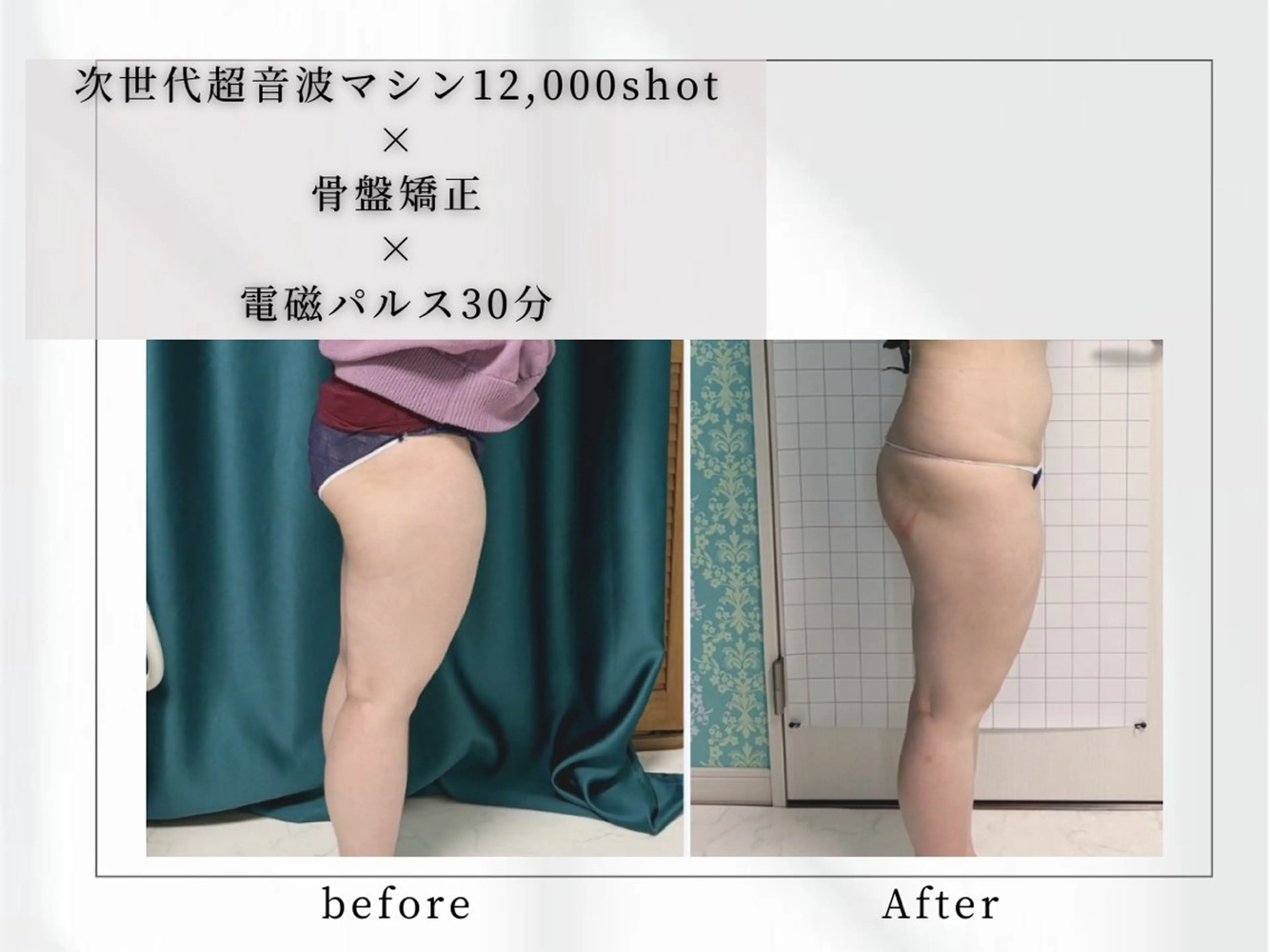 小顔矯正専門店 【RED】池田のエステ・リラクイメージ