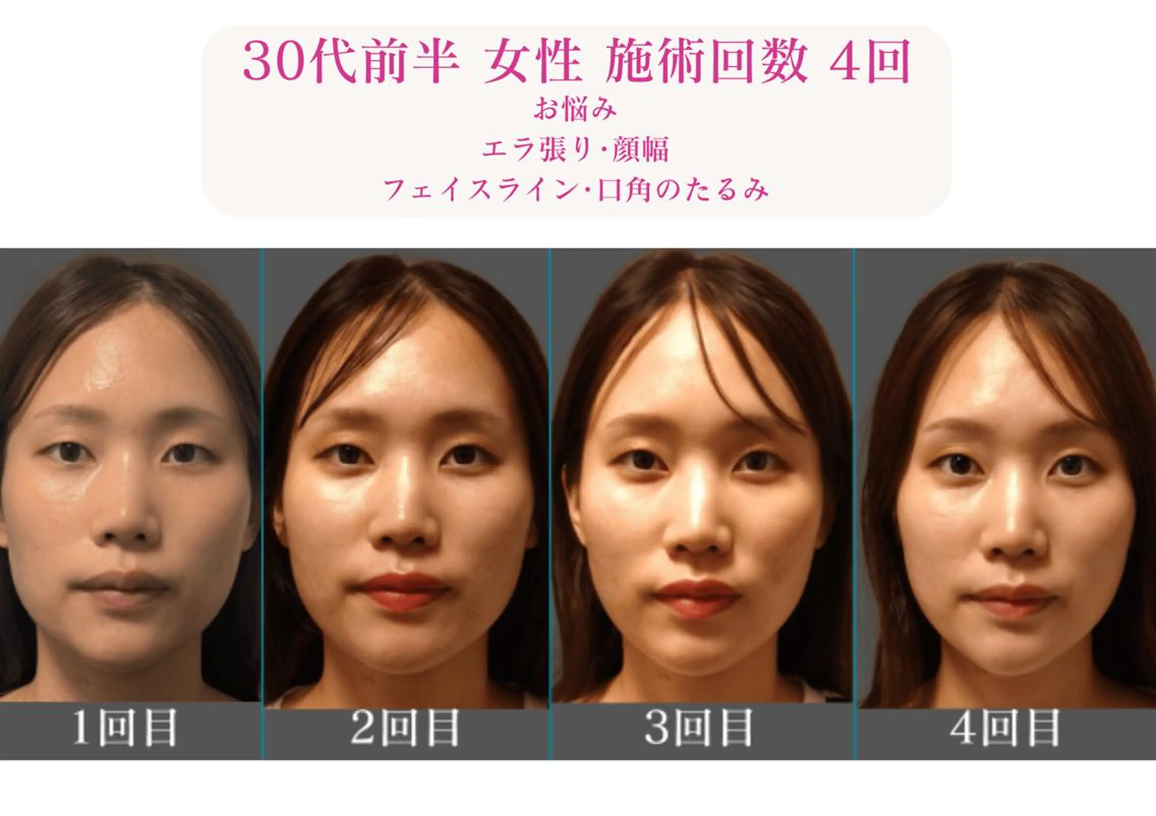 エステ リラク 美容とカラダの鍼灸 サロン やなけんのエステ・リラクイメージ