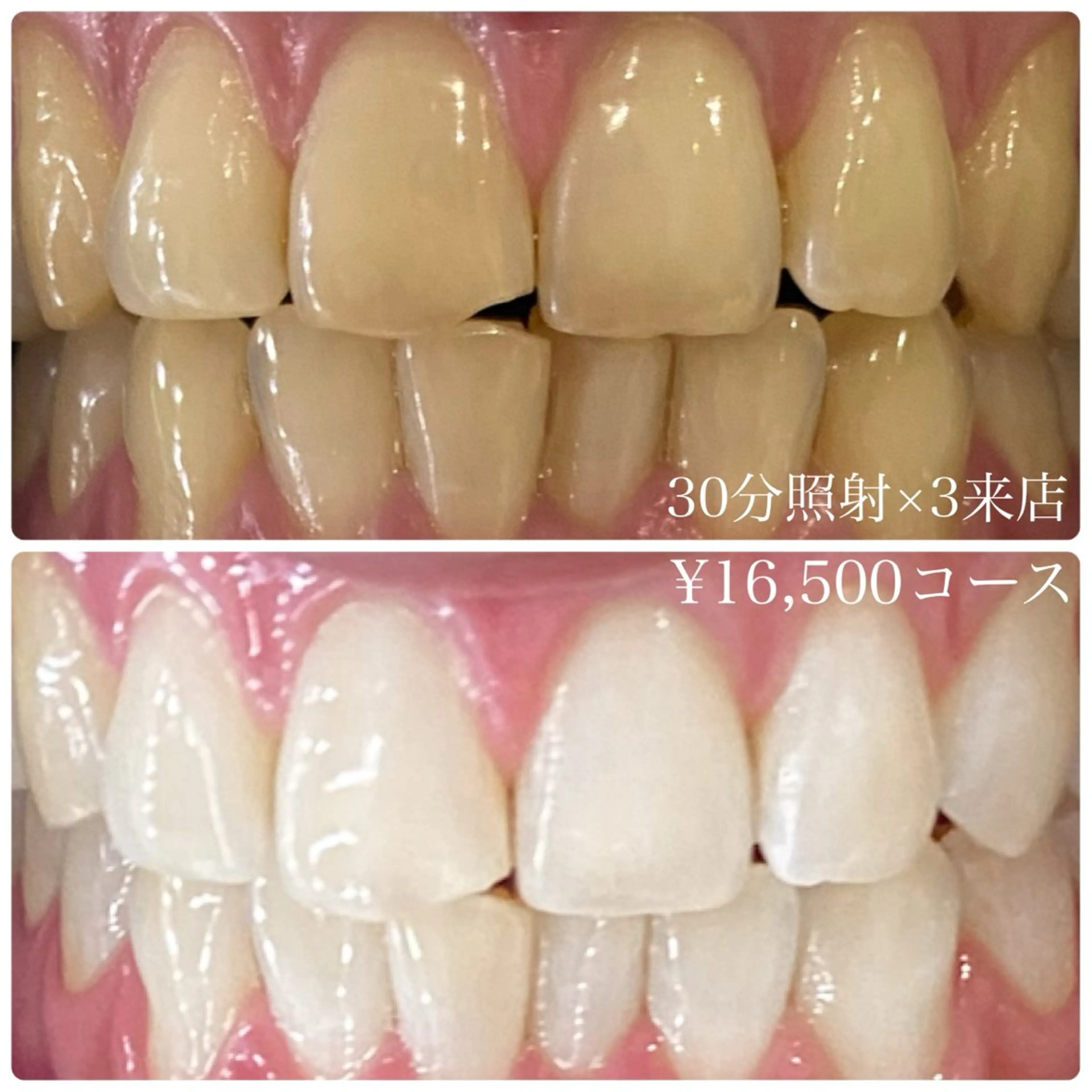 メンズ その他 ホワイトニングルーム 川崎店所属・ホワイトニング ルーム 川崎店のその他イメージ