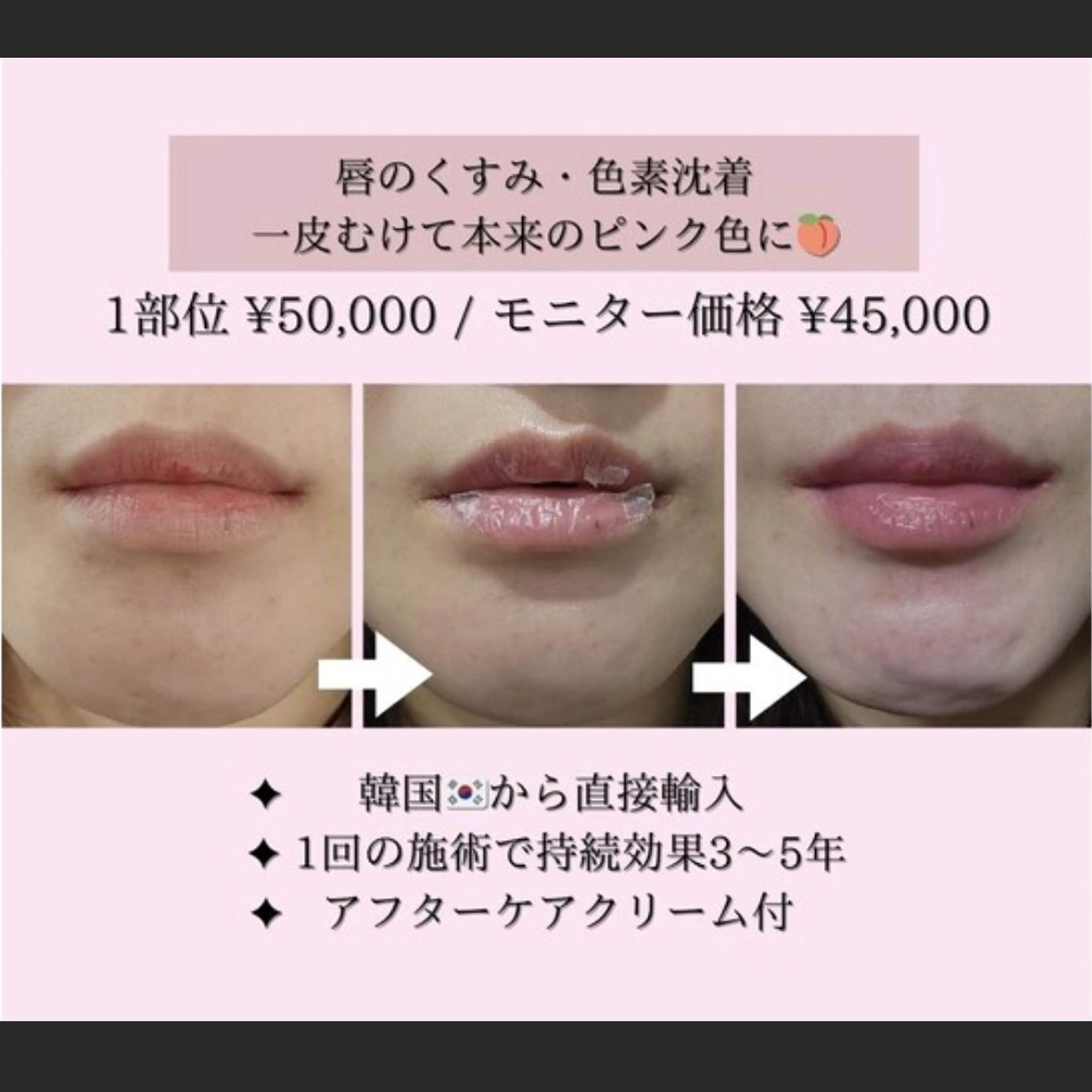 エステ 美肌ケアサロンiru博多祇園店所属・美肌ケアサロンiru 博多祇園店のエステ・リラクイメージ
