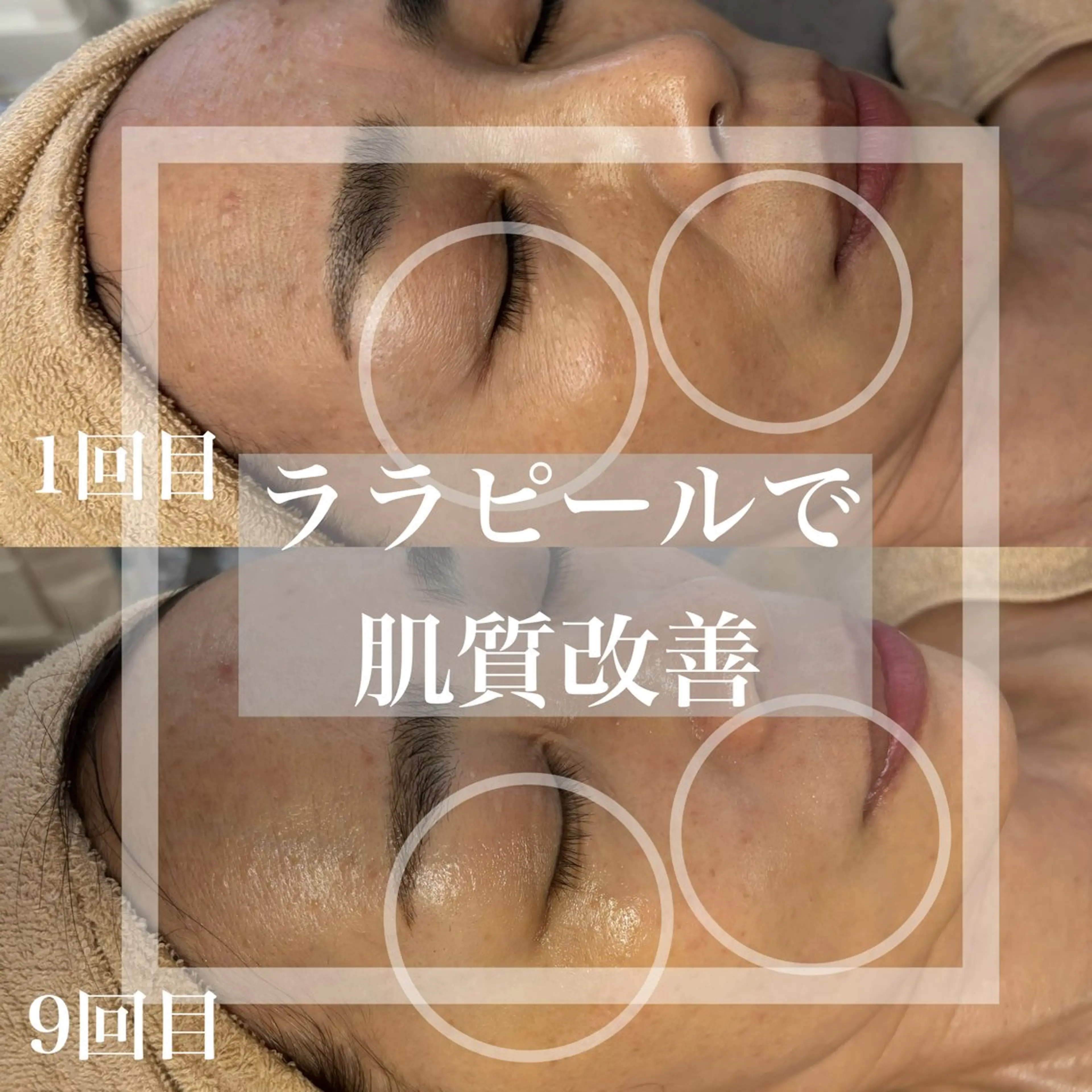 エステ WHITE AQUA 北千住店のエステ・リラクイメージ