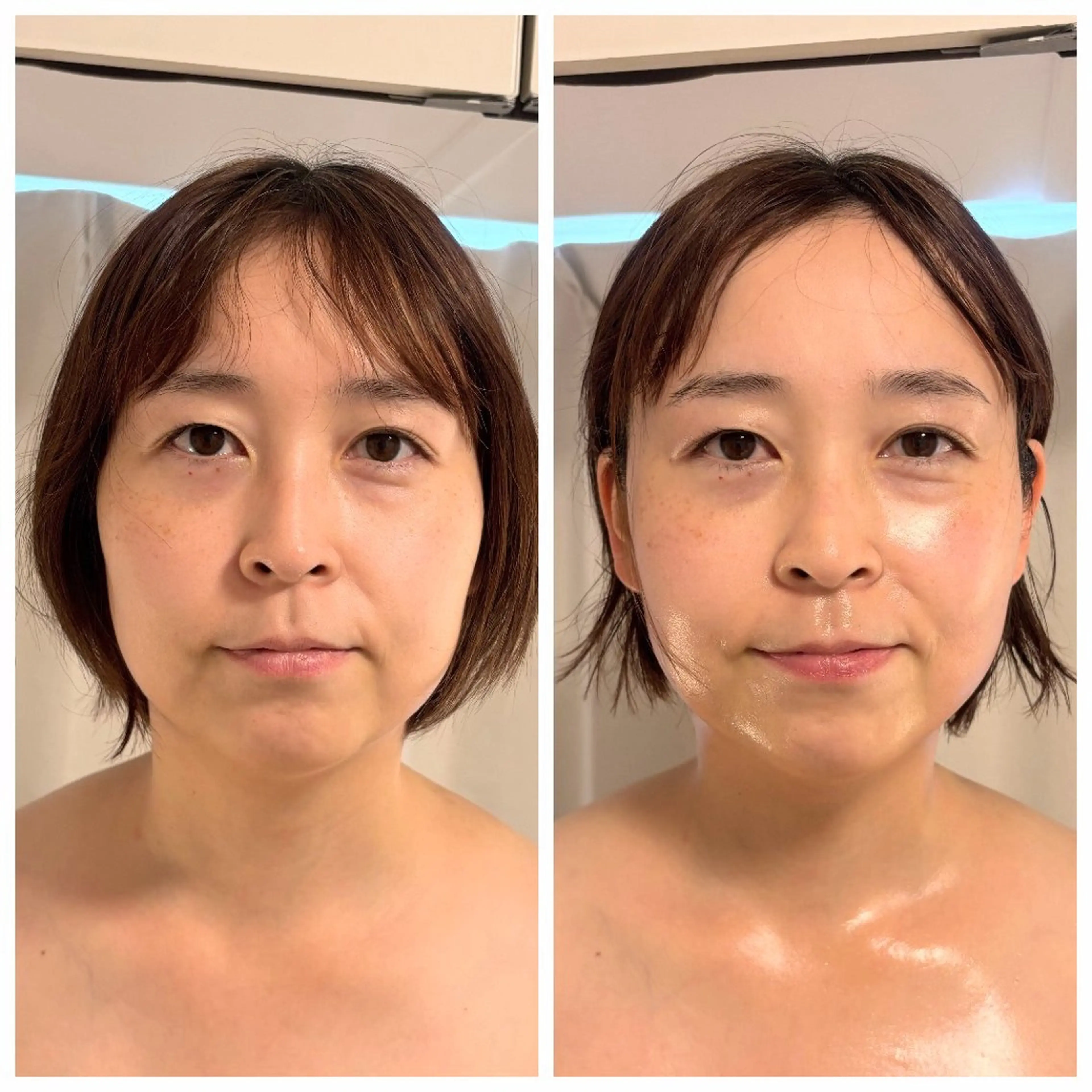 【たるみケア集中プログラム】45分×８回の写真