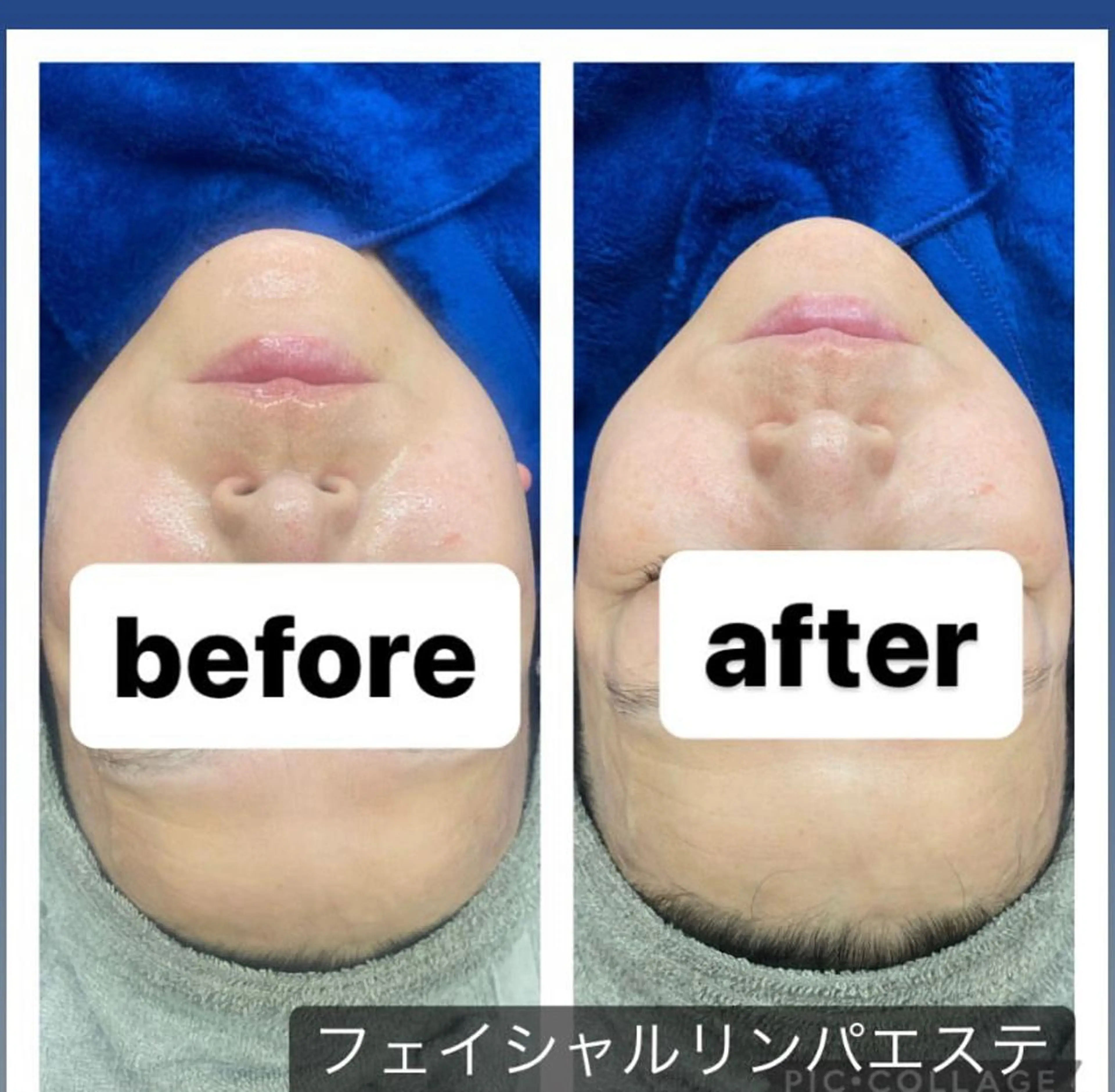 エステ RE:moom リムーム/脱毛エステのエステ・リラクイメージ