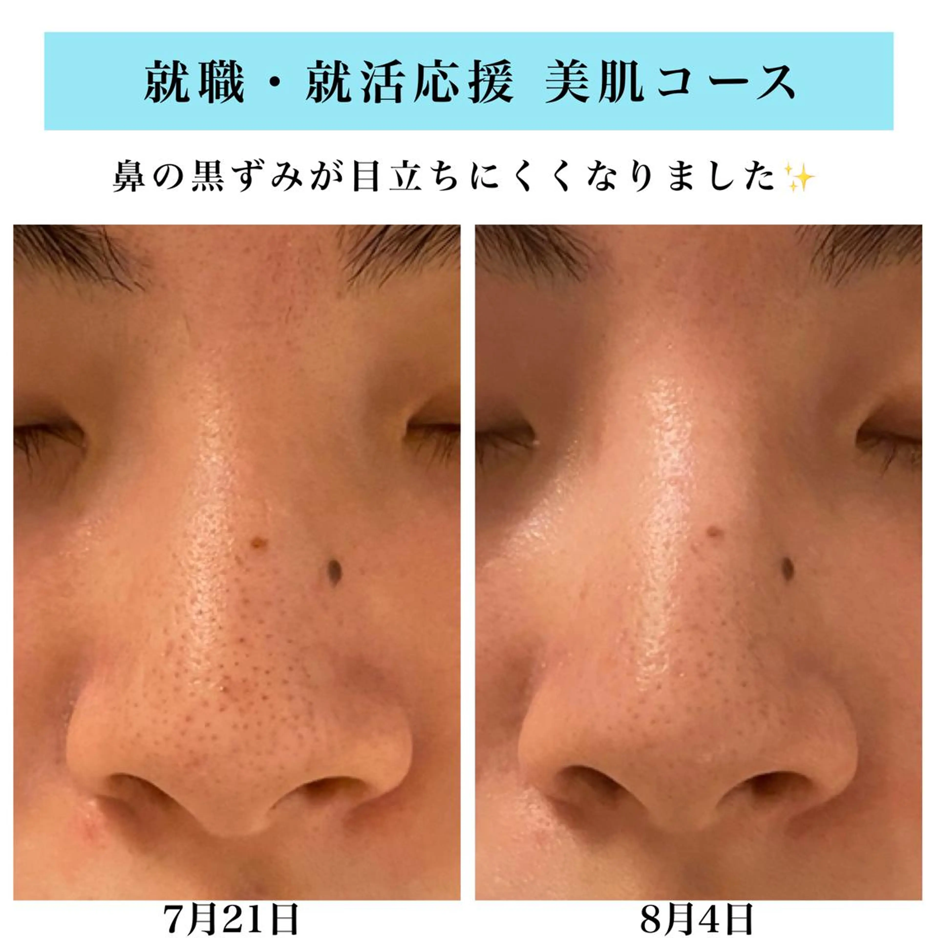 エステ Bellesthe （ベルエステ）のエステ・リラクイメージ