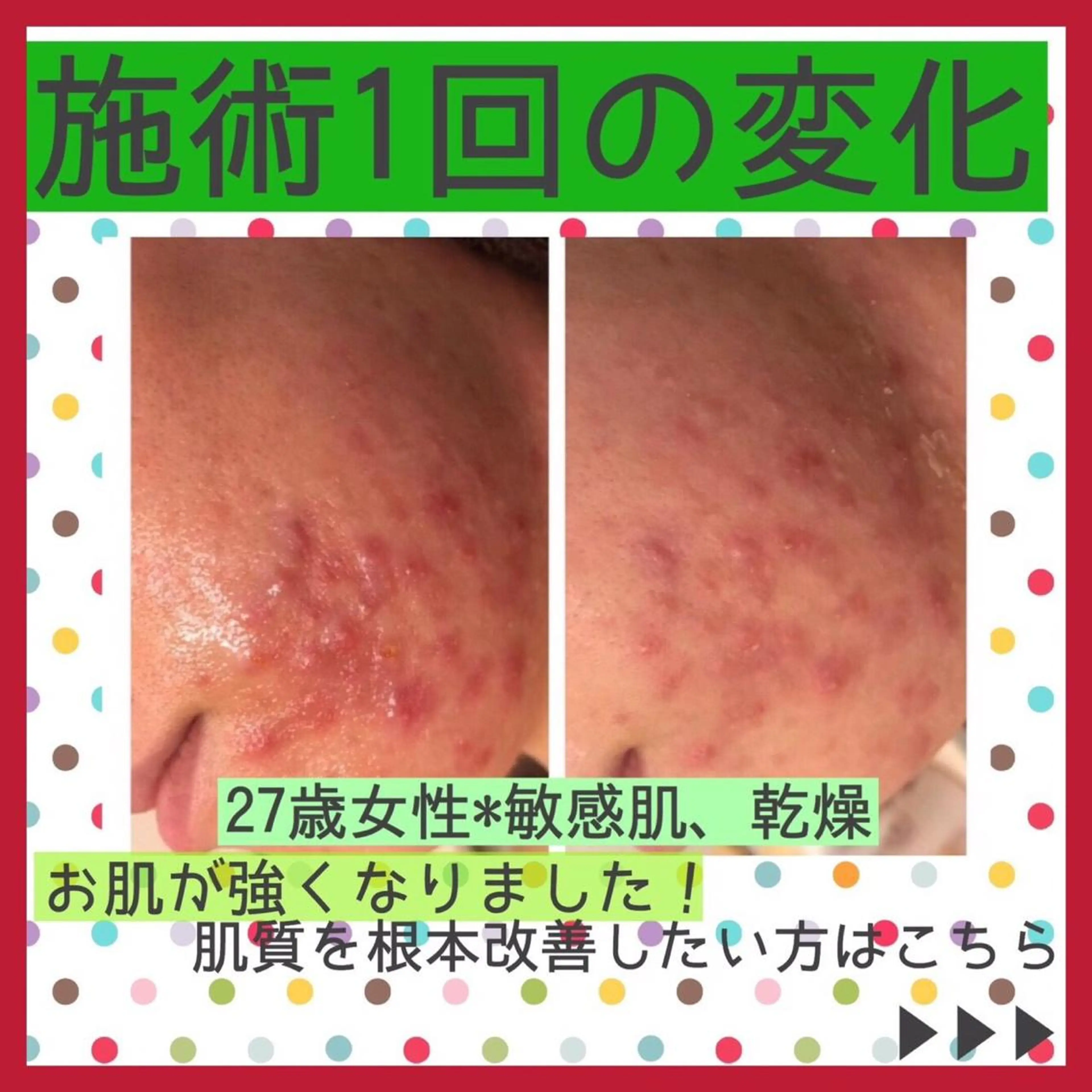 ミディアム カラー パーマ ヘアアレンジ メンズ キッズ ネイル マツエク・マツパ アイブロウ アクール　齋藤 ♡肌トラブル卒業のエステ・リラクイメージ