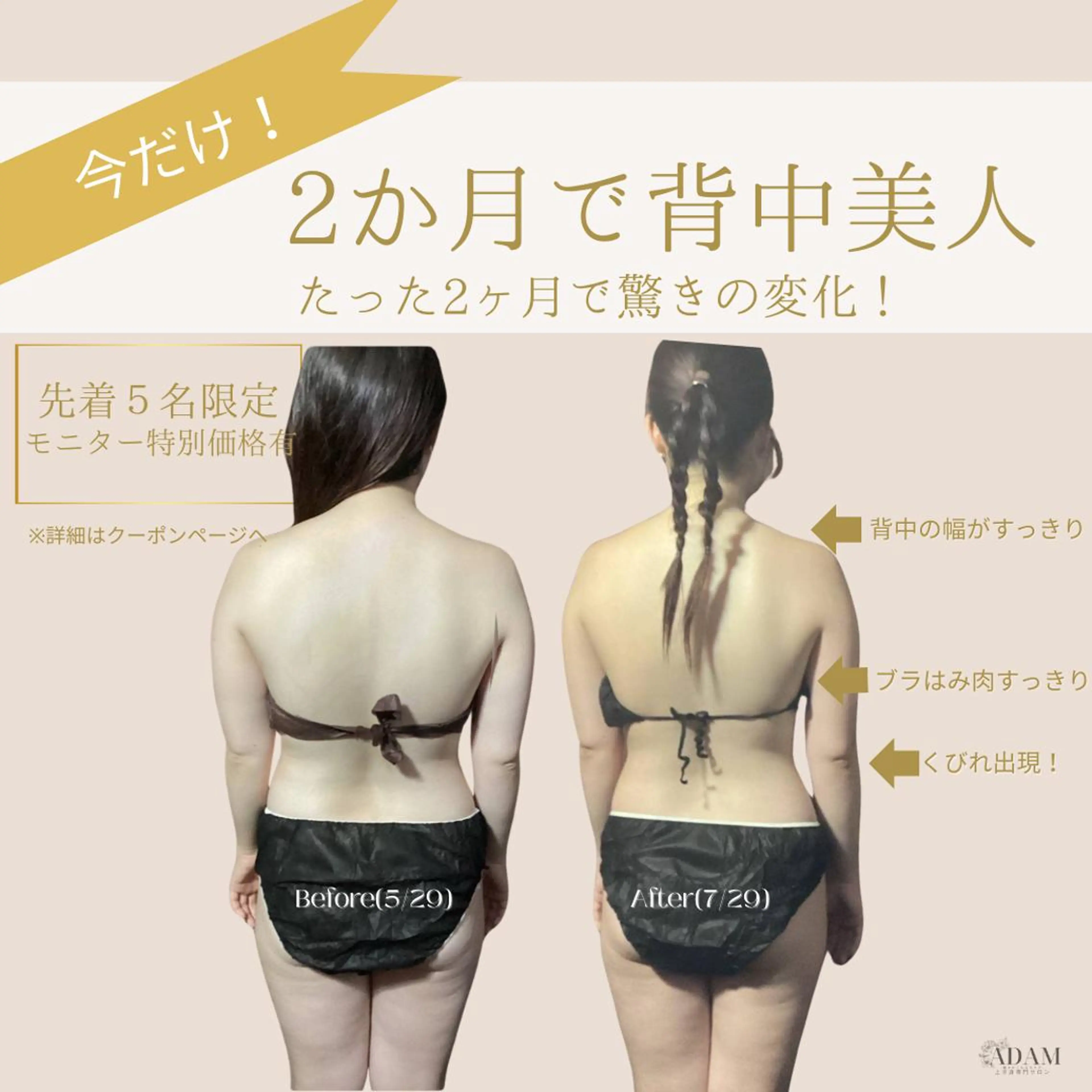 今だけ限定！30・40代残り各2名🔥２か月集中上半身ダイエット🔥モニター様募集!!の写真