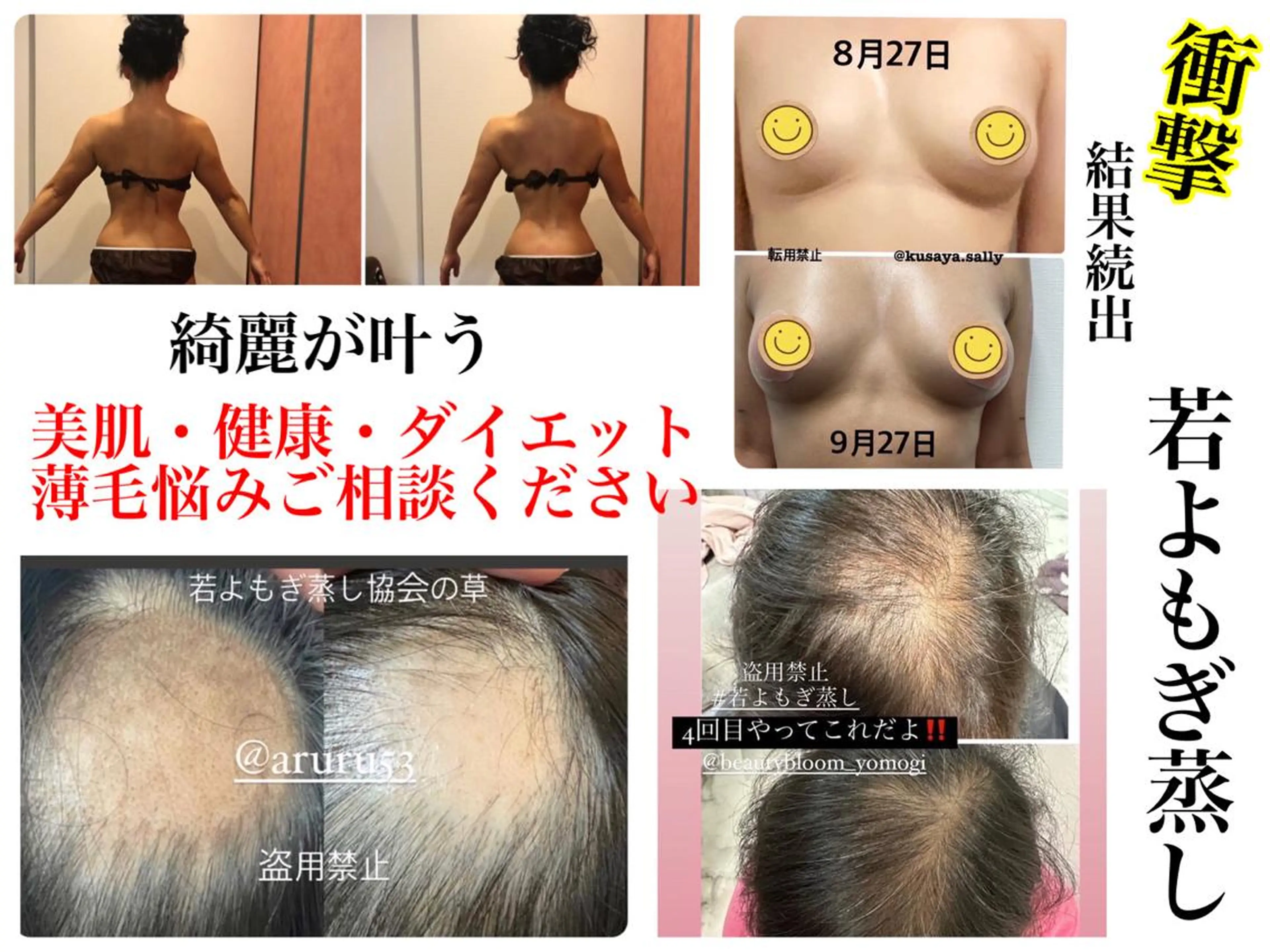 その他 private salon  Dea_maris シュガーリング＆パーソナルボディケア所属・グランプリ受賞👑肌 体も別人級に変えるのその他イメージ