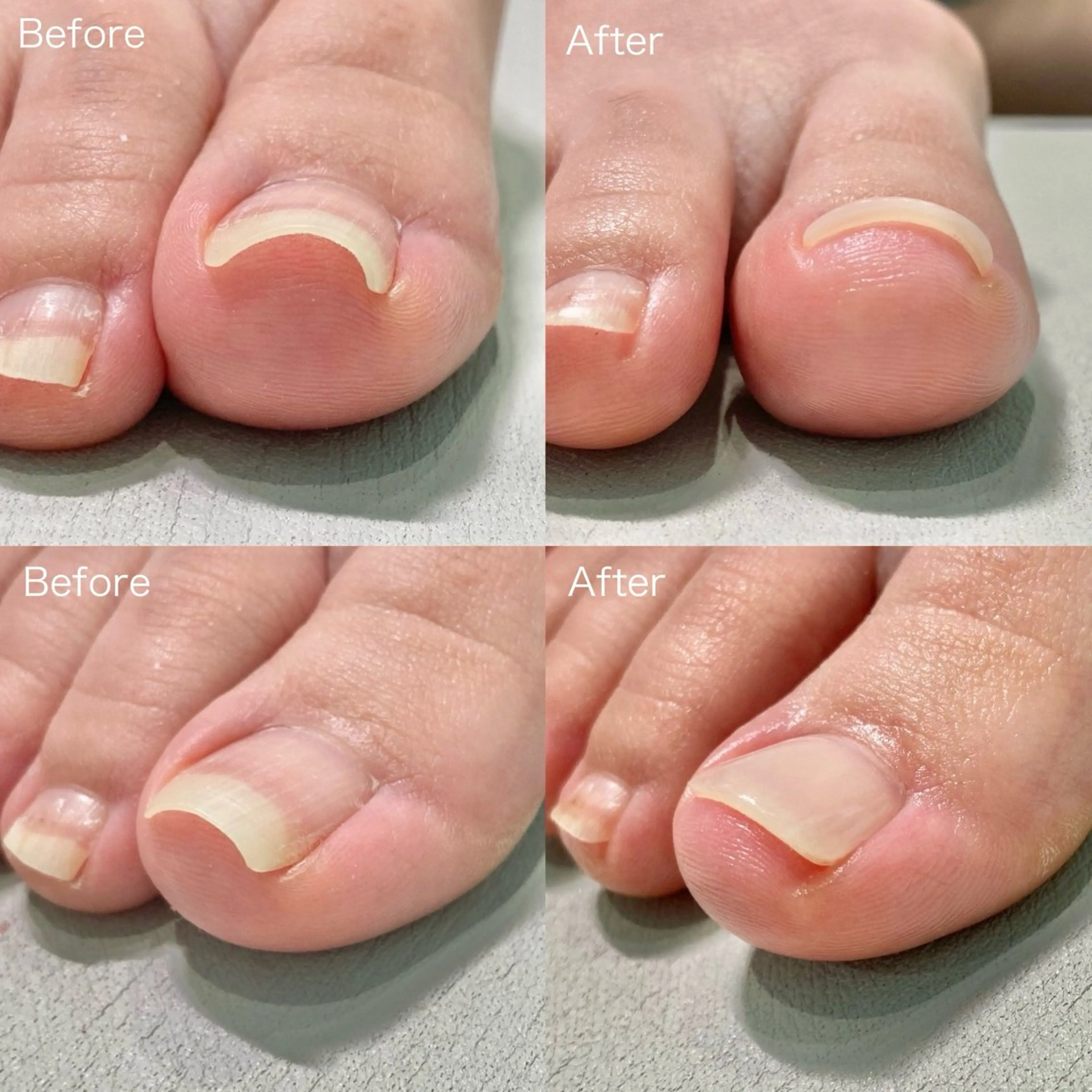 ネイル 小野 絵美のネイルデザイン