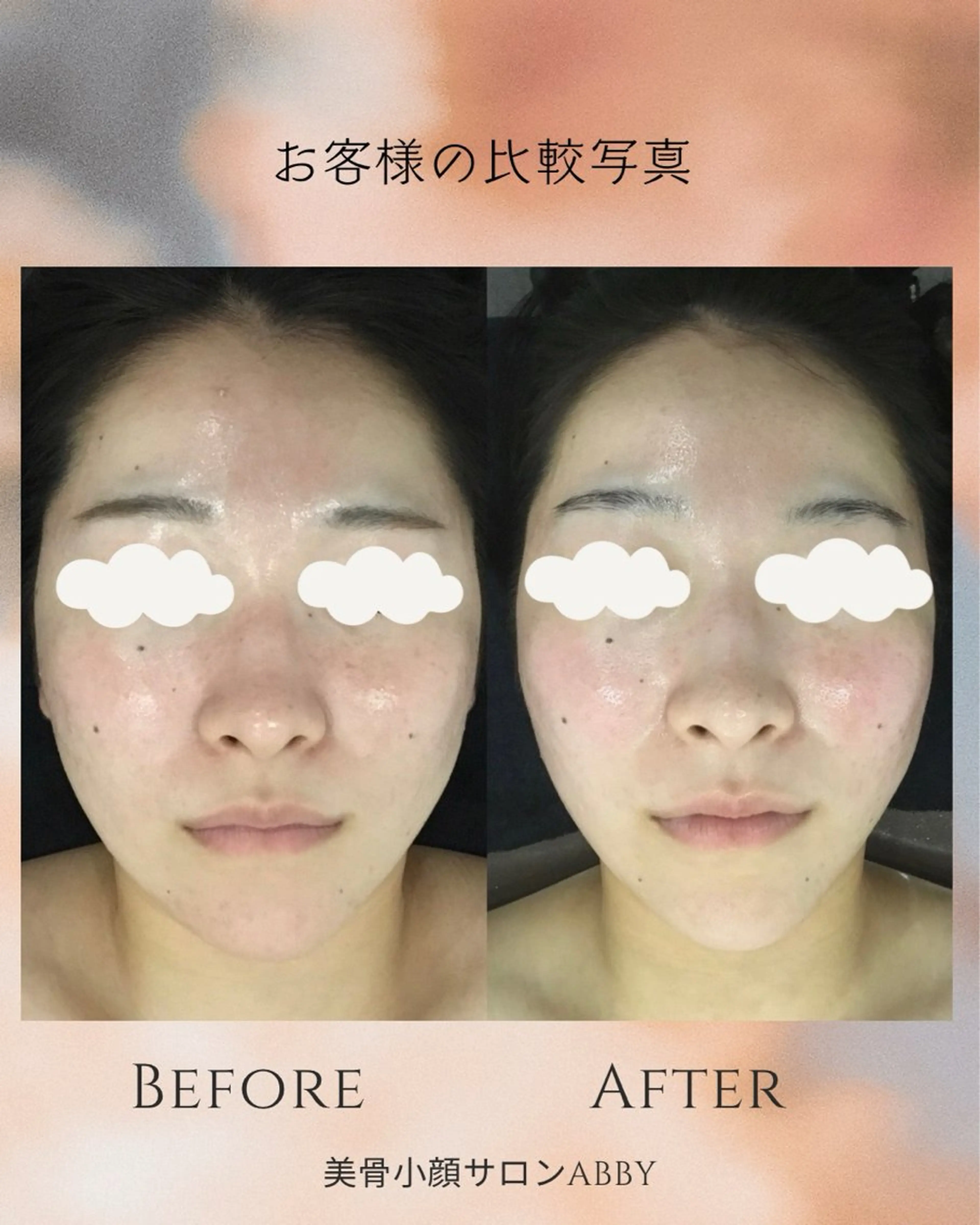 エステ リラク 小顔コルギ💎 ABBY SANOのエステ・リラクイメージ
