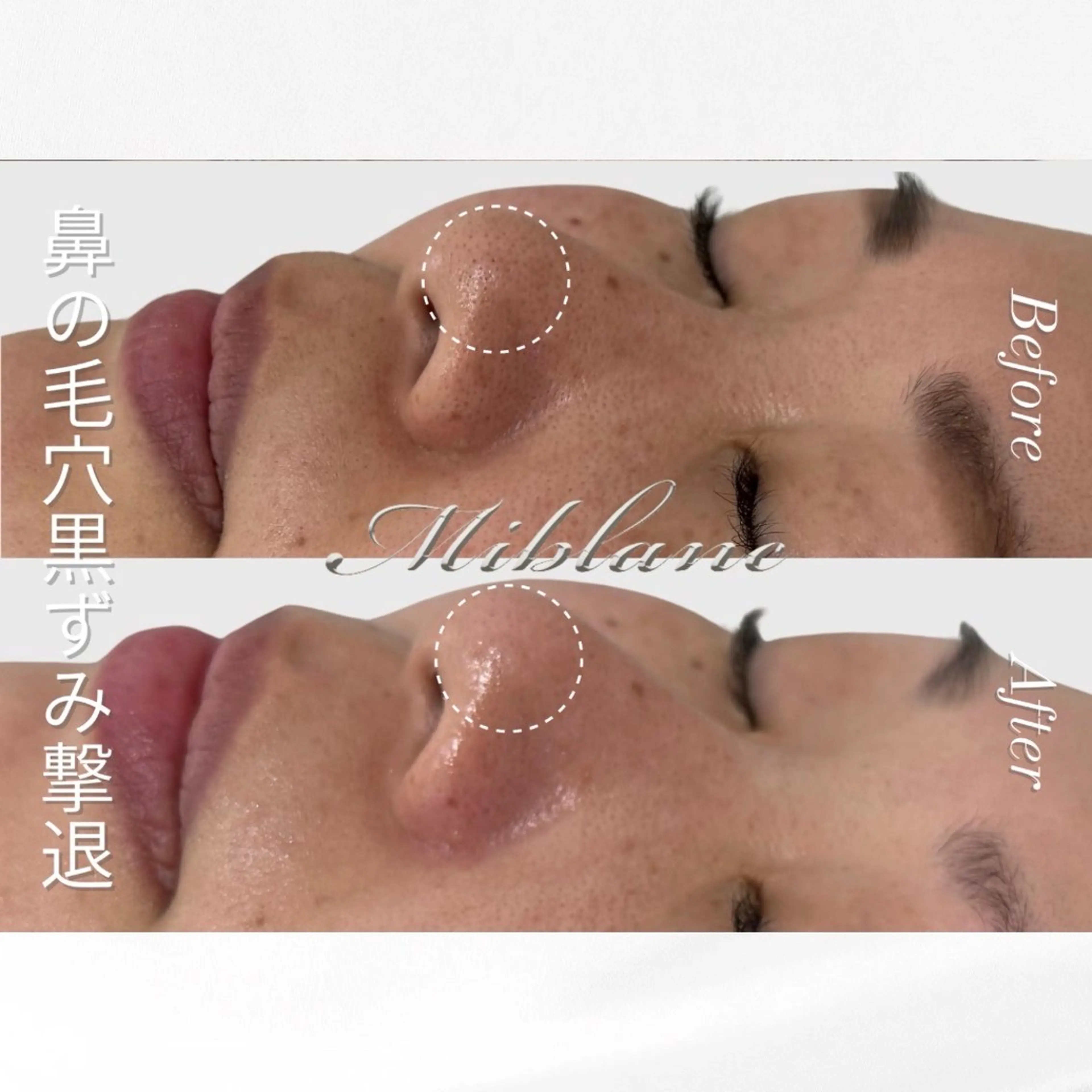 肌質管理 MIBLANC上野店のその他イメージ