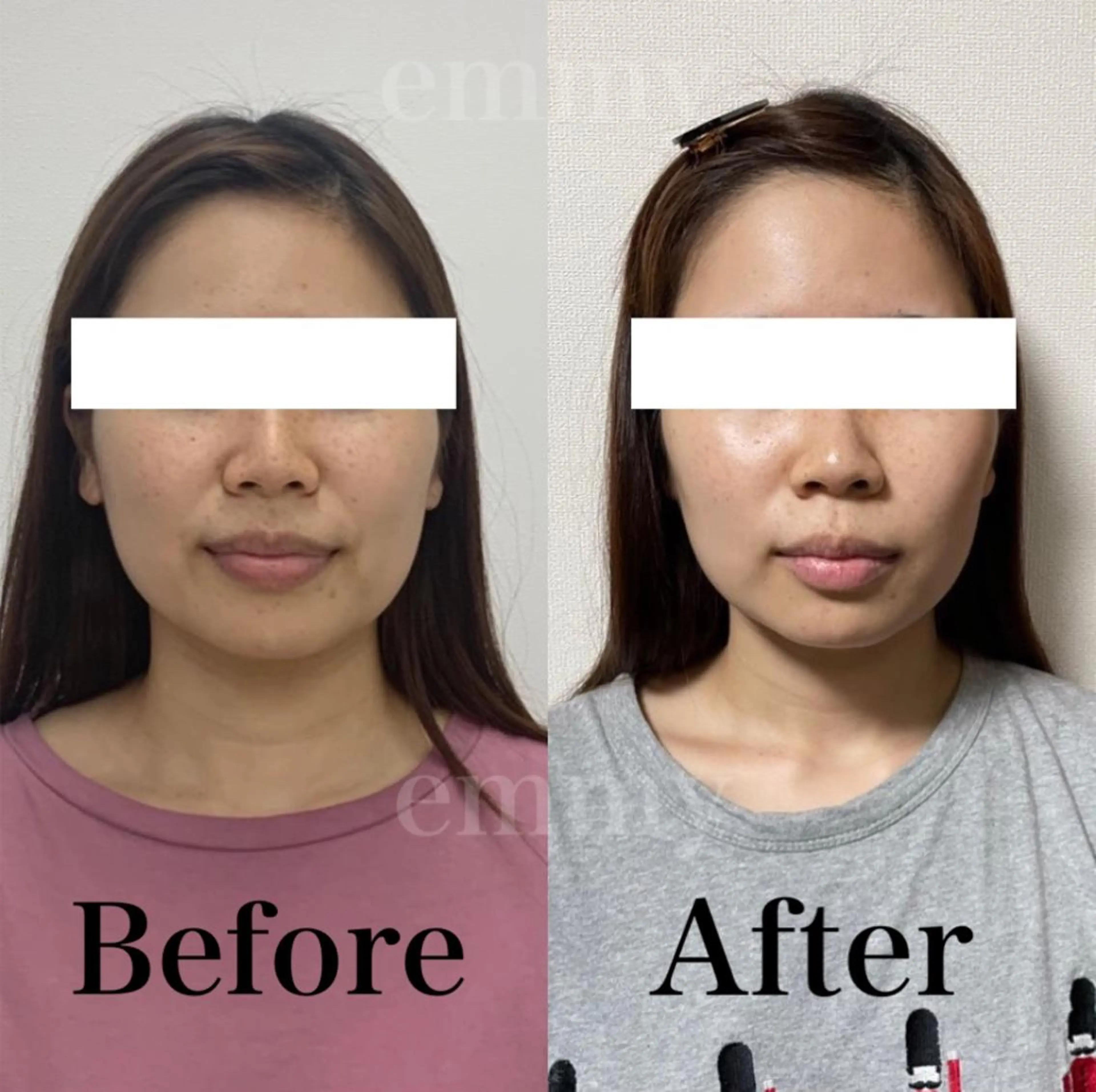 小顔と ヘッドスパのお店のエステ・リラクイメージ