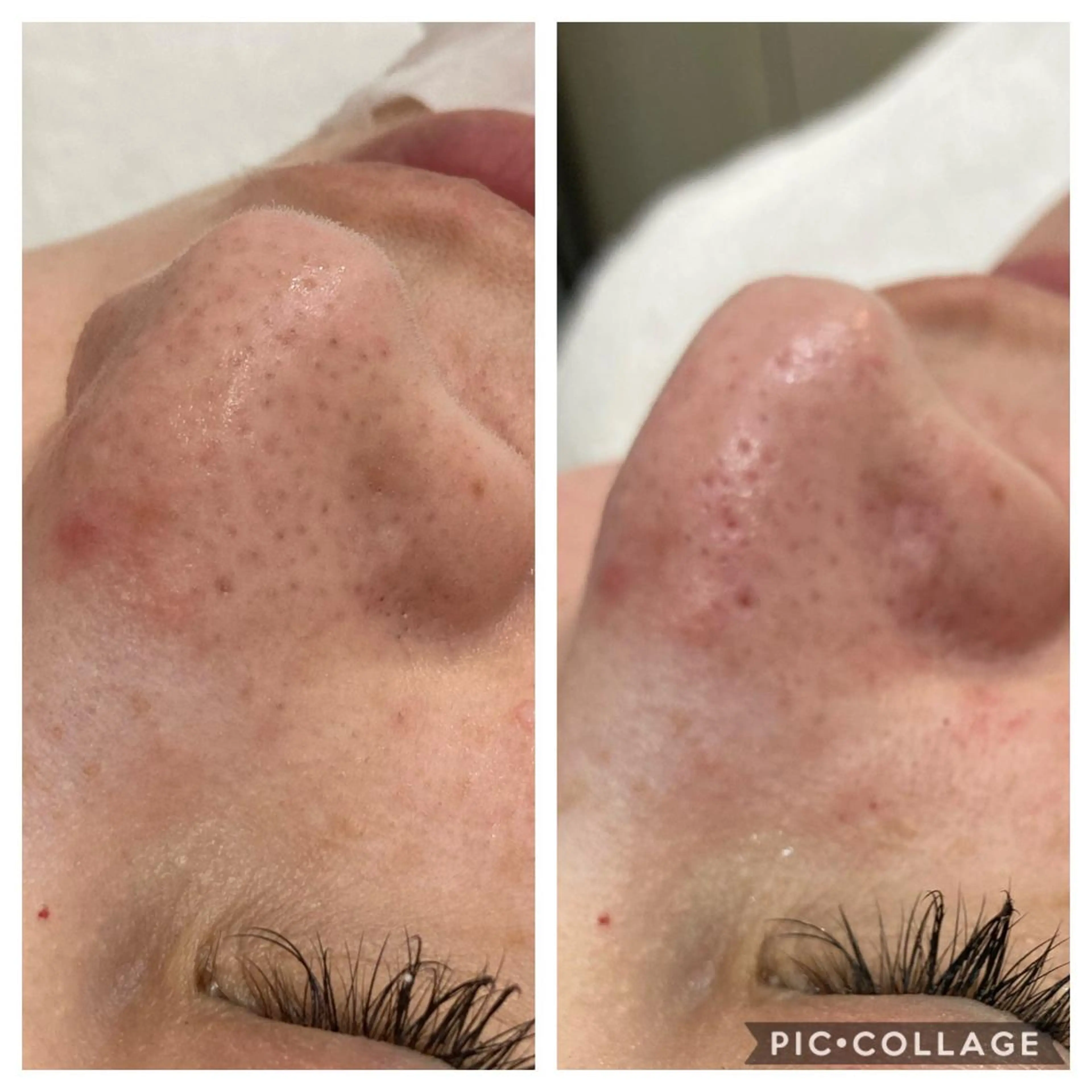 メンズ エステ リラク Ｂ&H所属・頭痛•肩こり専門/ 眉サロンB&H心斎橋のエステ・リラクイメージ