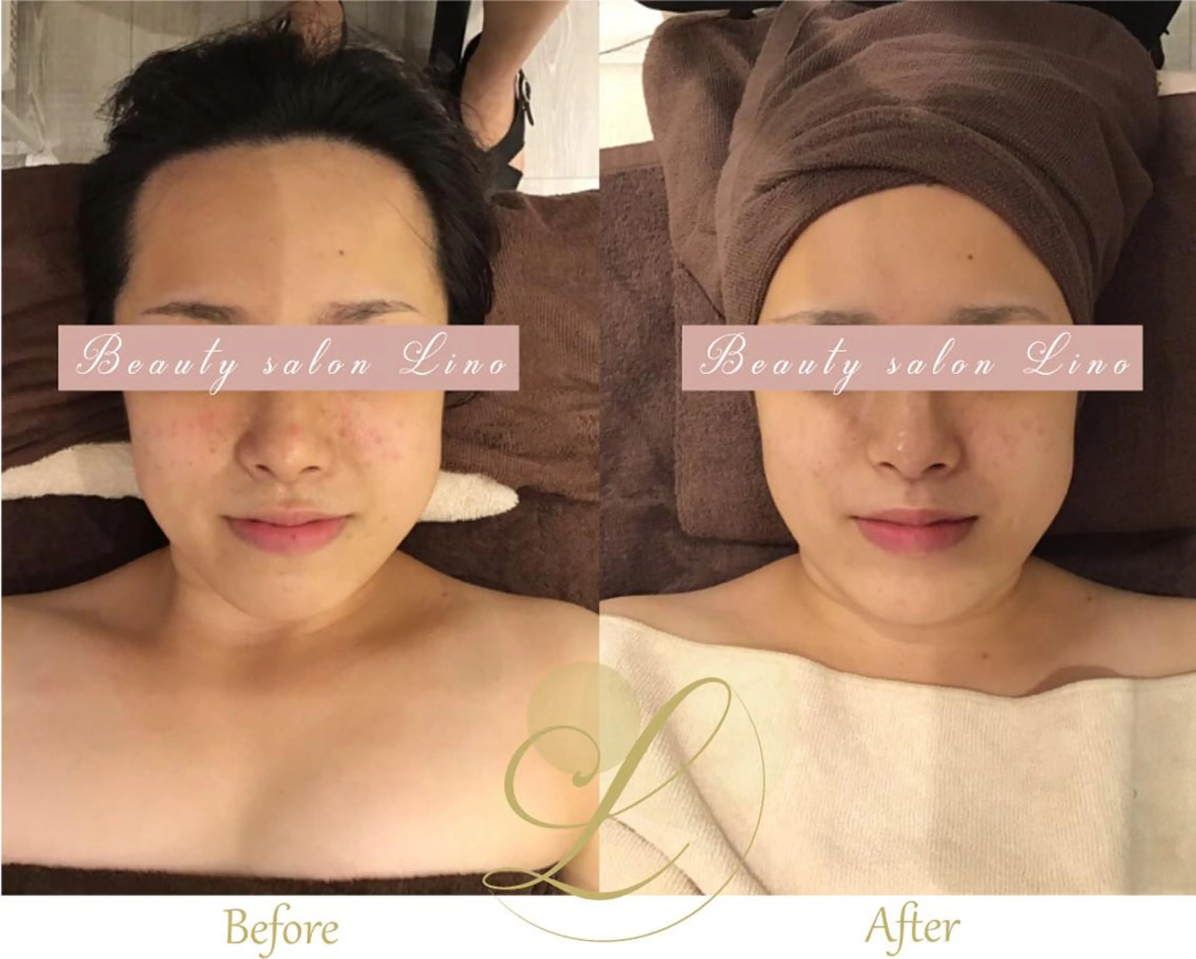 痩身×フェイシャル ブライダル|Linoのエステ・リラクイメージ