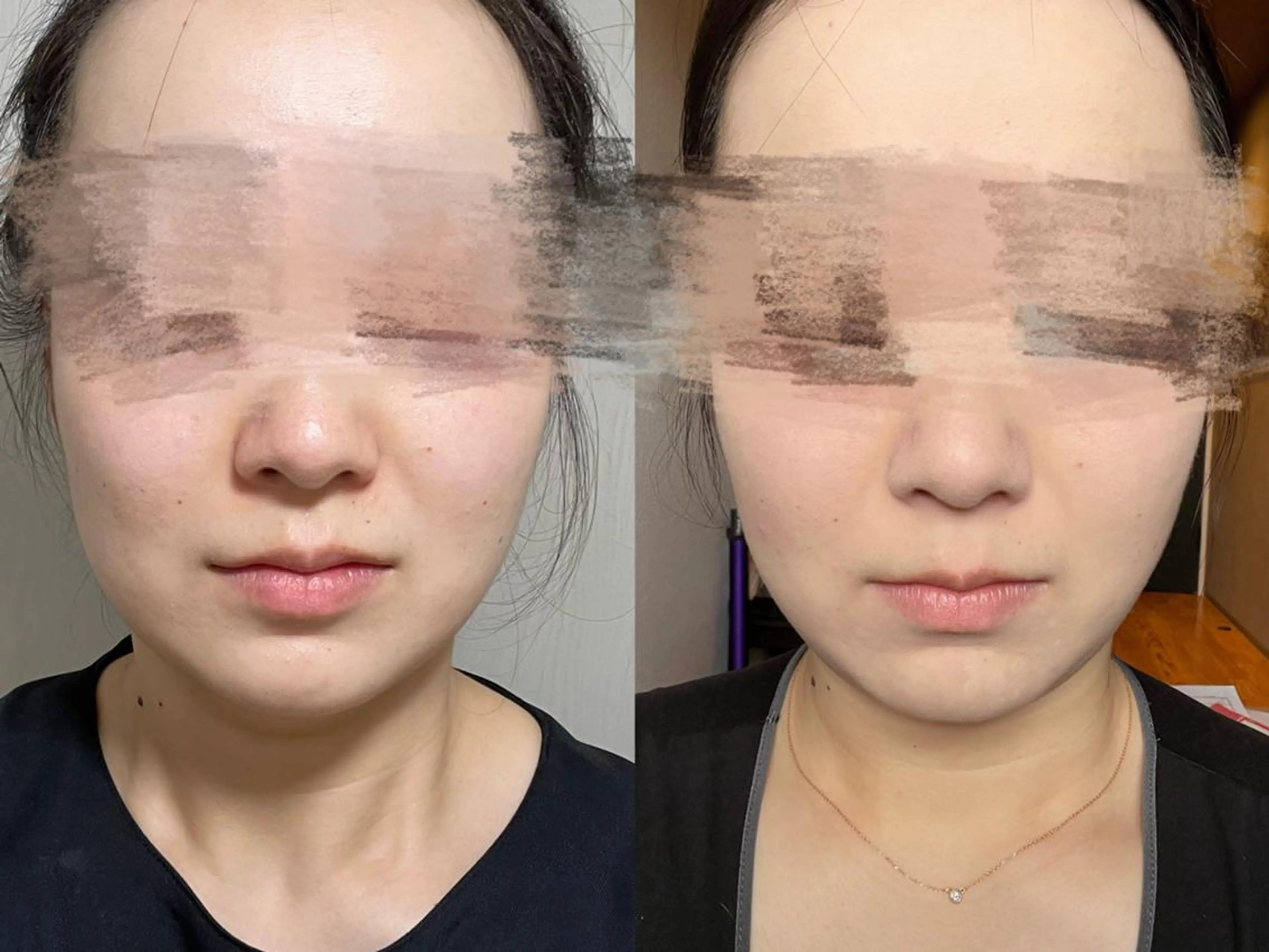 エステ OPREA 千種店のエステ・リラクイメージ